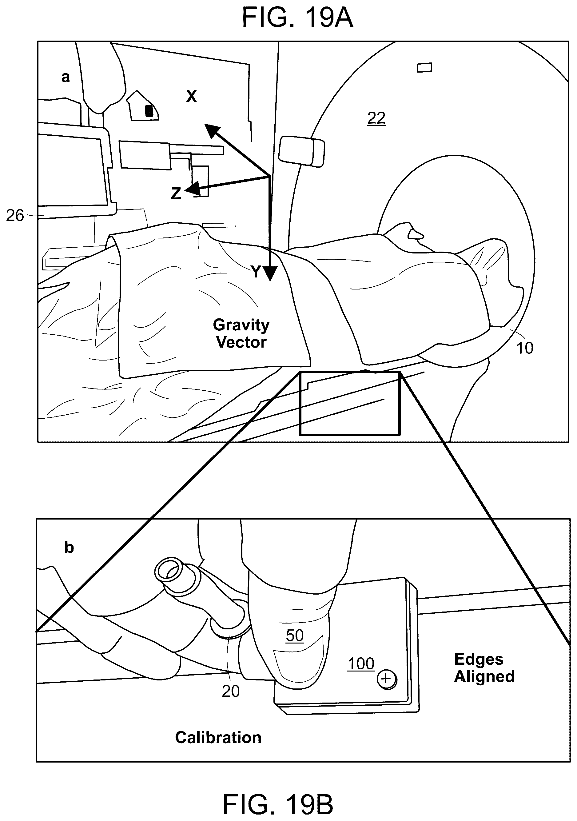 Patent US12320646 Figure 19 – Systems, method and devices for assisting or performing guiding interventional procedures using inertial measurement units and magnetometer sensors