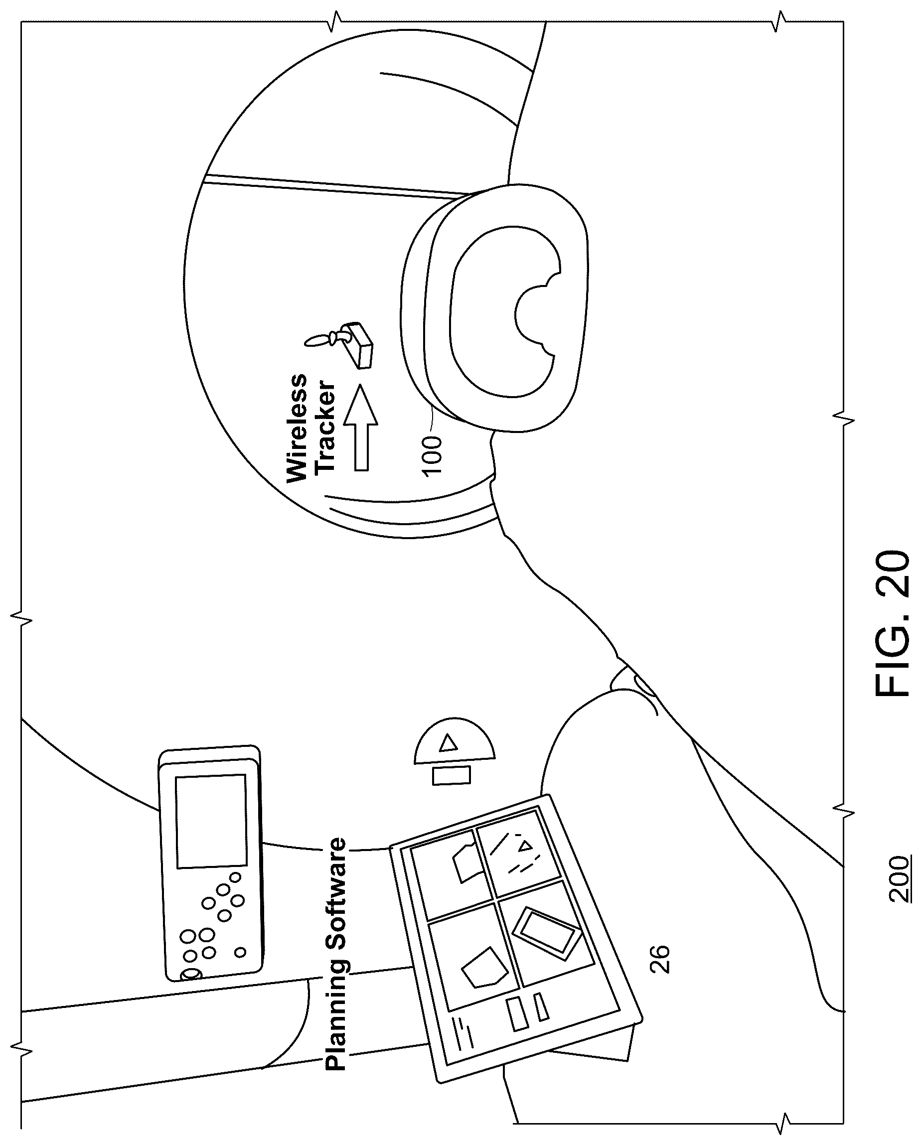 Patent US12320646 Figure 20 – Systems, method and devices for assisting or performing guiding interventional procedures using inertial measurement units and magnetometer sensors