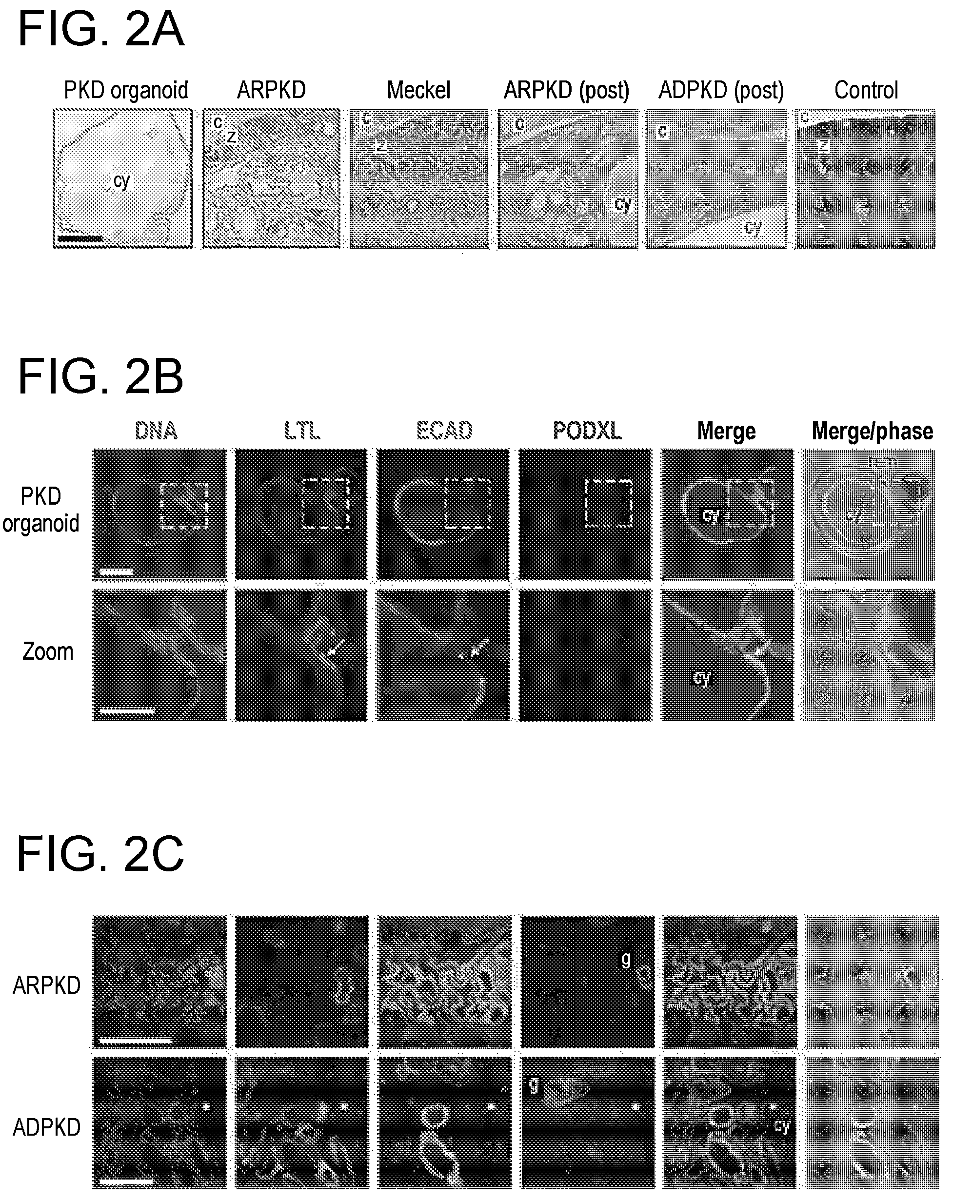 Patent US12320800 Figure 3 – High-throughput automation of organoids for identifying therapeutic strategies