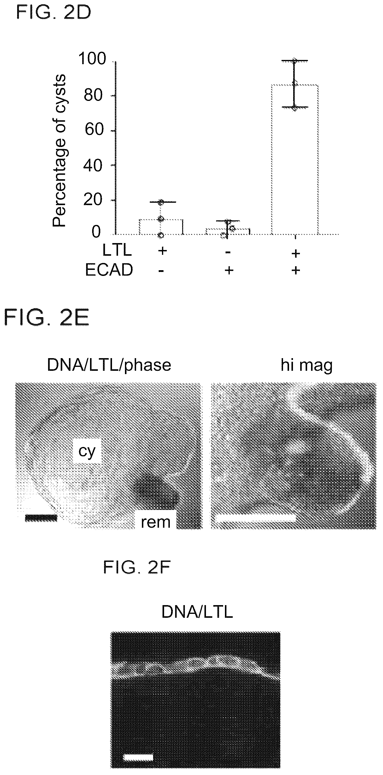 Patent US12320800 Figure 4 – High-throughput automation of organoids for identifying therapeutic strategies