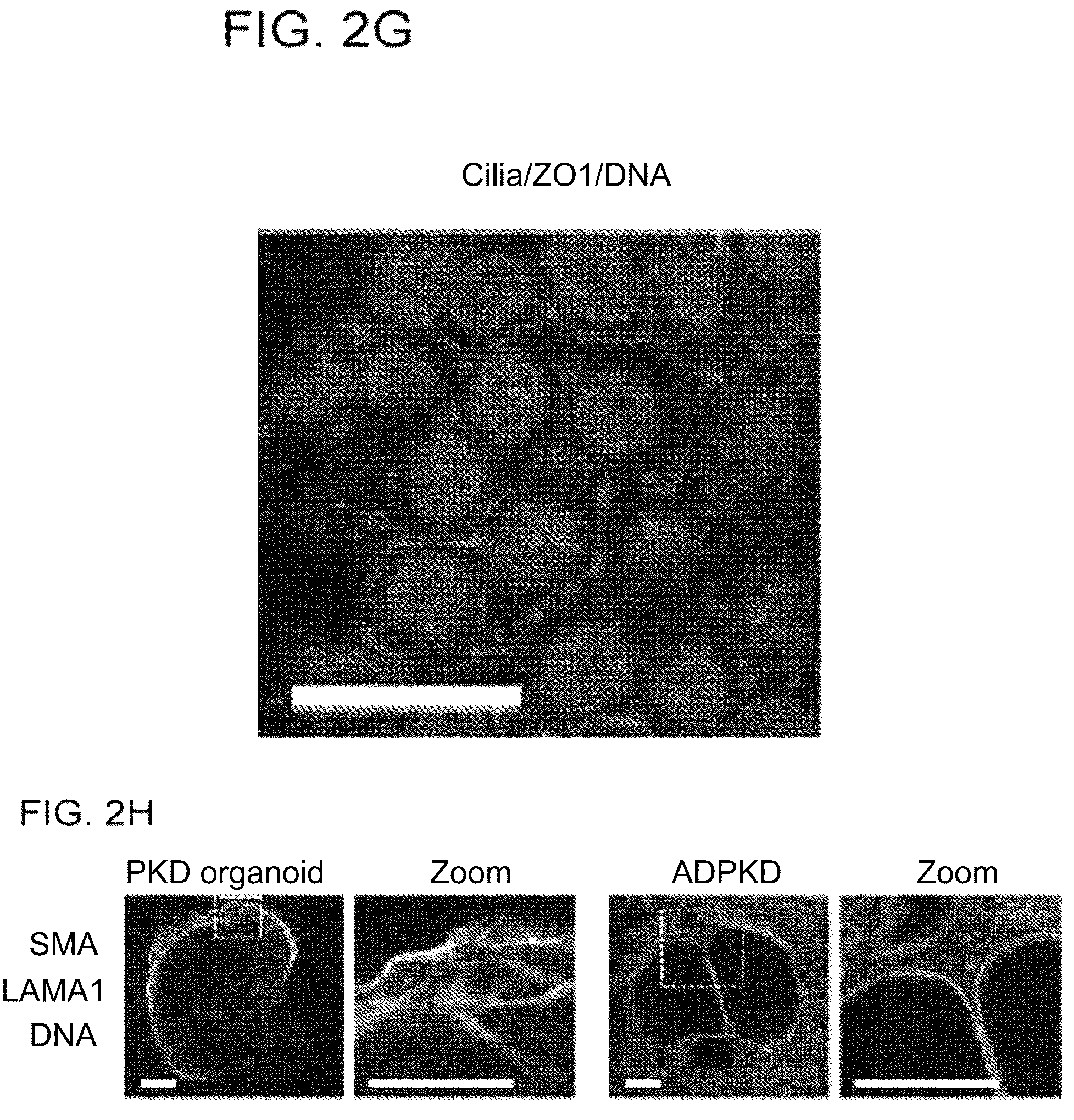 Patent US12320800 Figure 5 – High-throughput automation of organoids for identifying therapeutic strategies