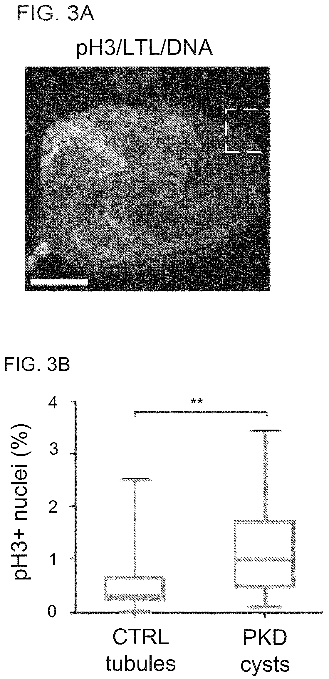 Patent US12320800 Figure 6 – High-throughput automation of organoids for identifying therapeutic strategies