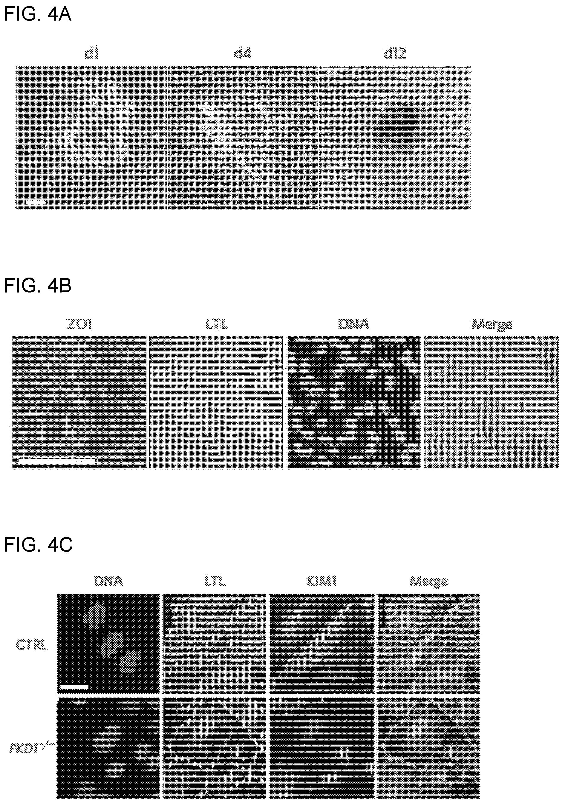 Patent US12320800 Figure 10 – High-throughput automation of organoids for identifying therapeutic strategies