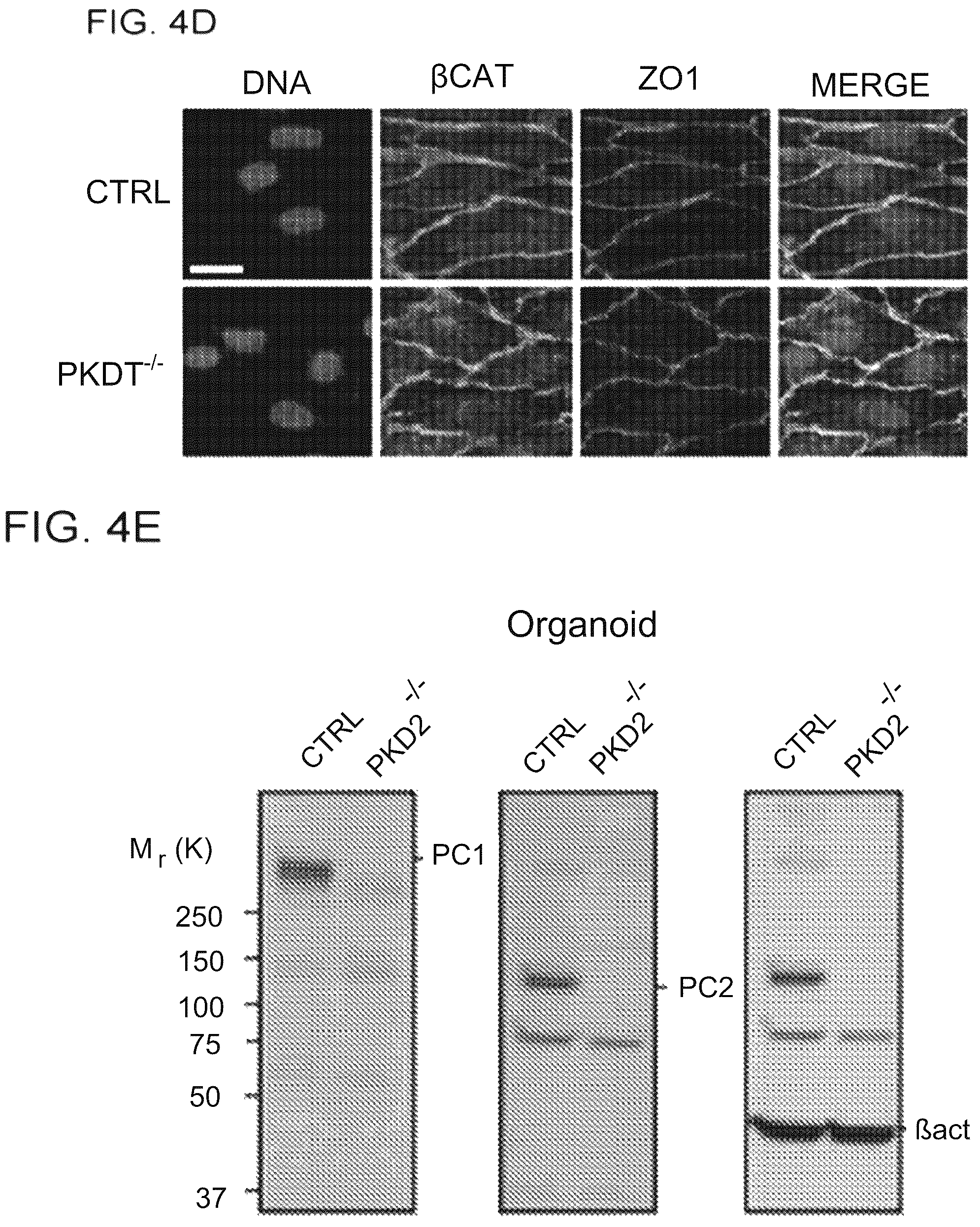 Patent US12320800 Figure 11 – High-throughput automation of organoids for identifying therapeutic strategies