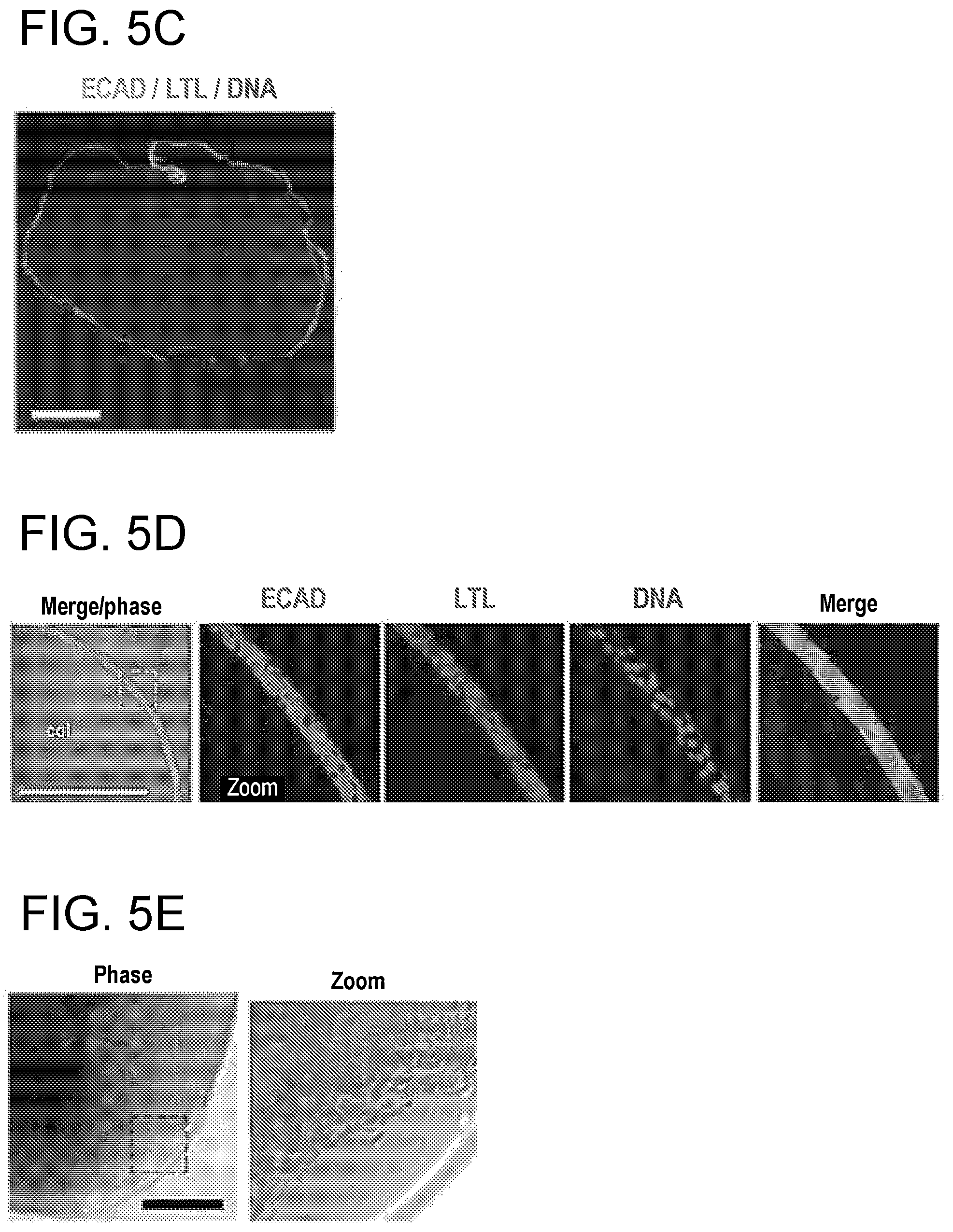 Patent US12320800 Figure 16 – High-throughput automation of organoids for identifying therapeutic strategies