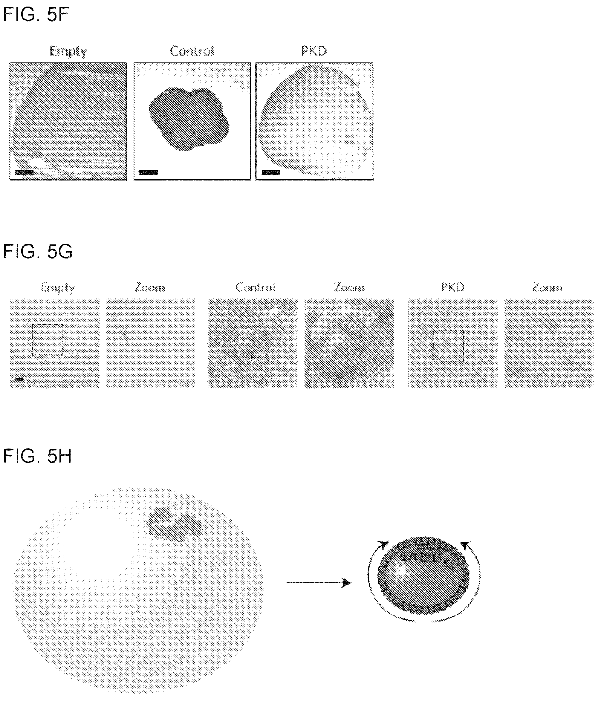 Patent US12320800 Figure 17 – High-throughput automation of organoids for identifying therapeutic strategies