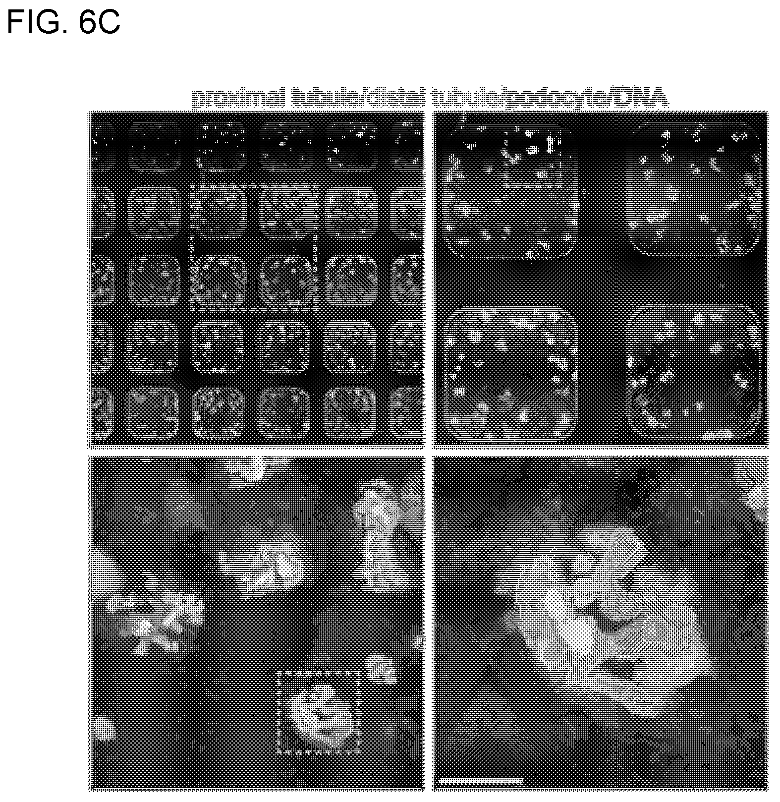 Patent US12320800 Figure 19 – High-throughput automation of organoids for identifying therapeutic strategies