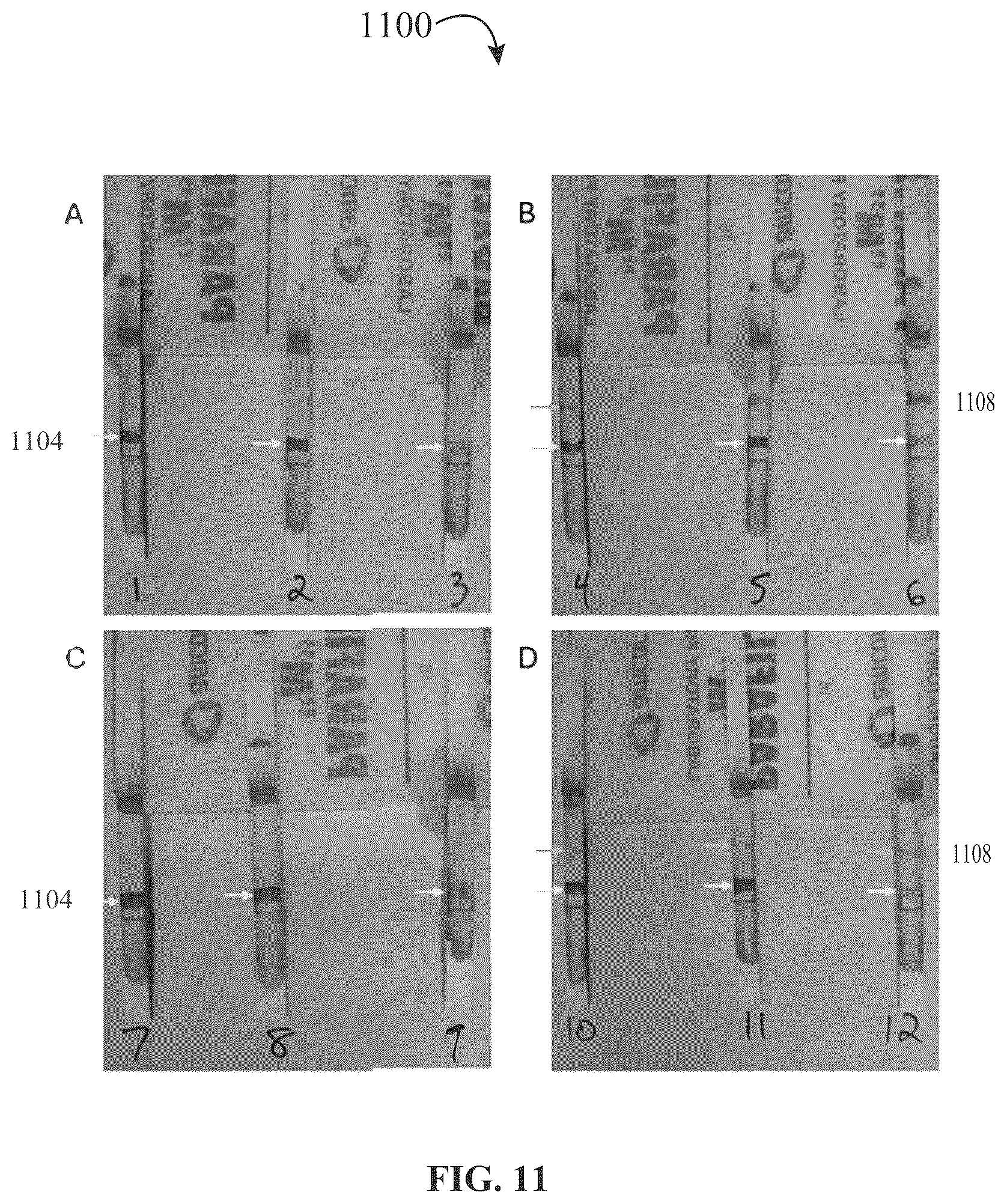 Patent US12320816 Figure 11 – Assay device for diagnosis of open-globe ocular injuries