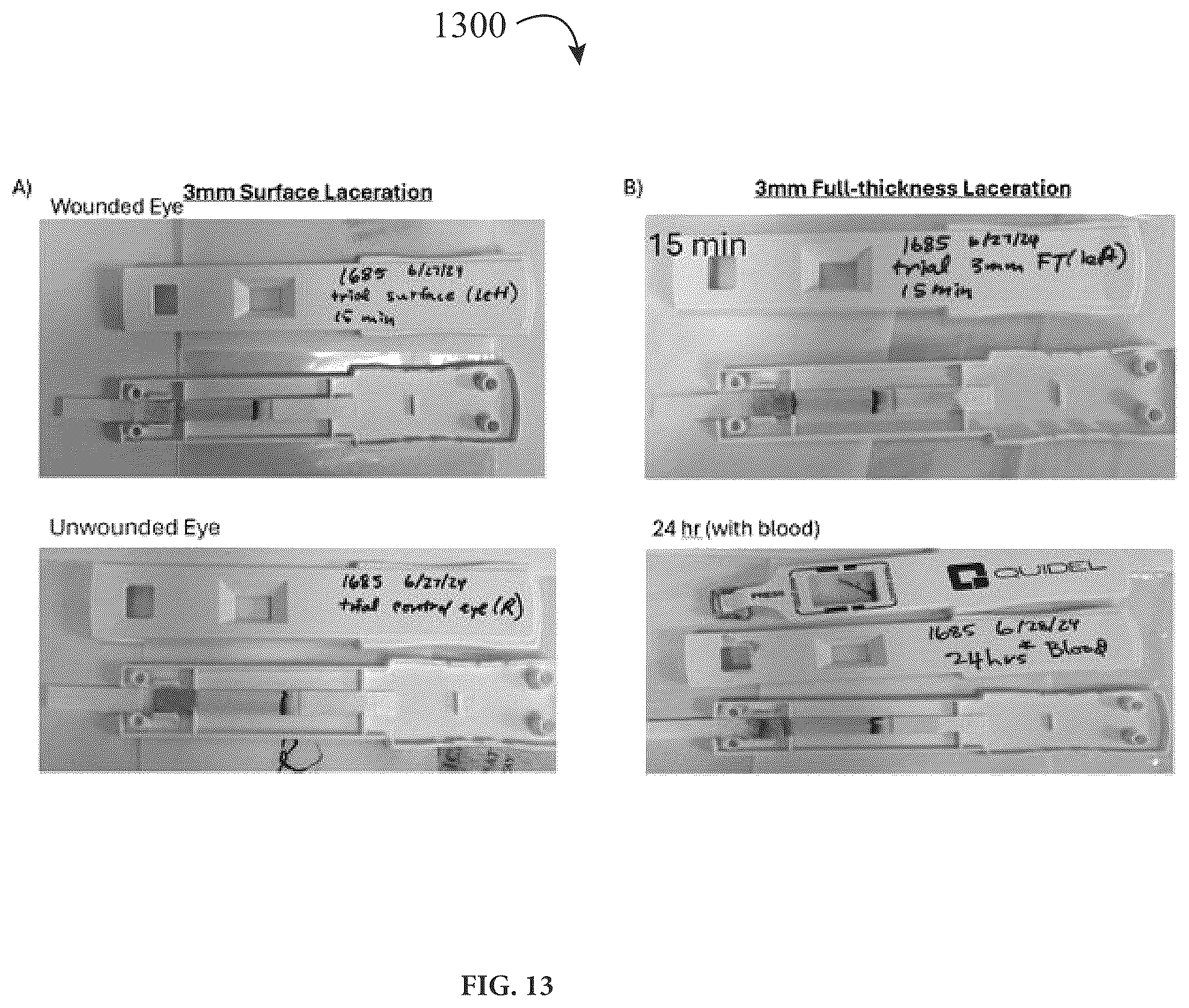 Patent US12320816 Figure 13 – Assay device for diagnosis of open-globe ocular injuries