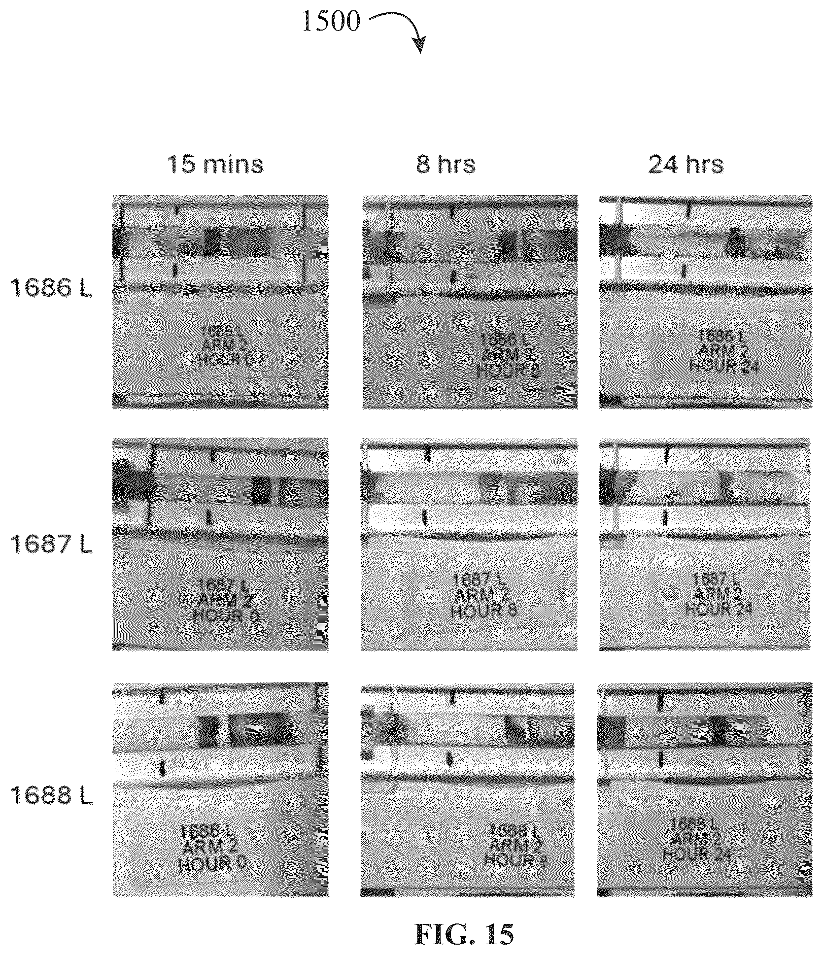 Patent US12320816 Figure 15 – Assay device for diagnosis of open-globe ocular injuries