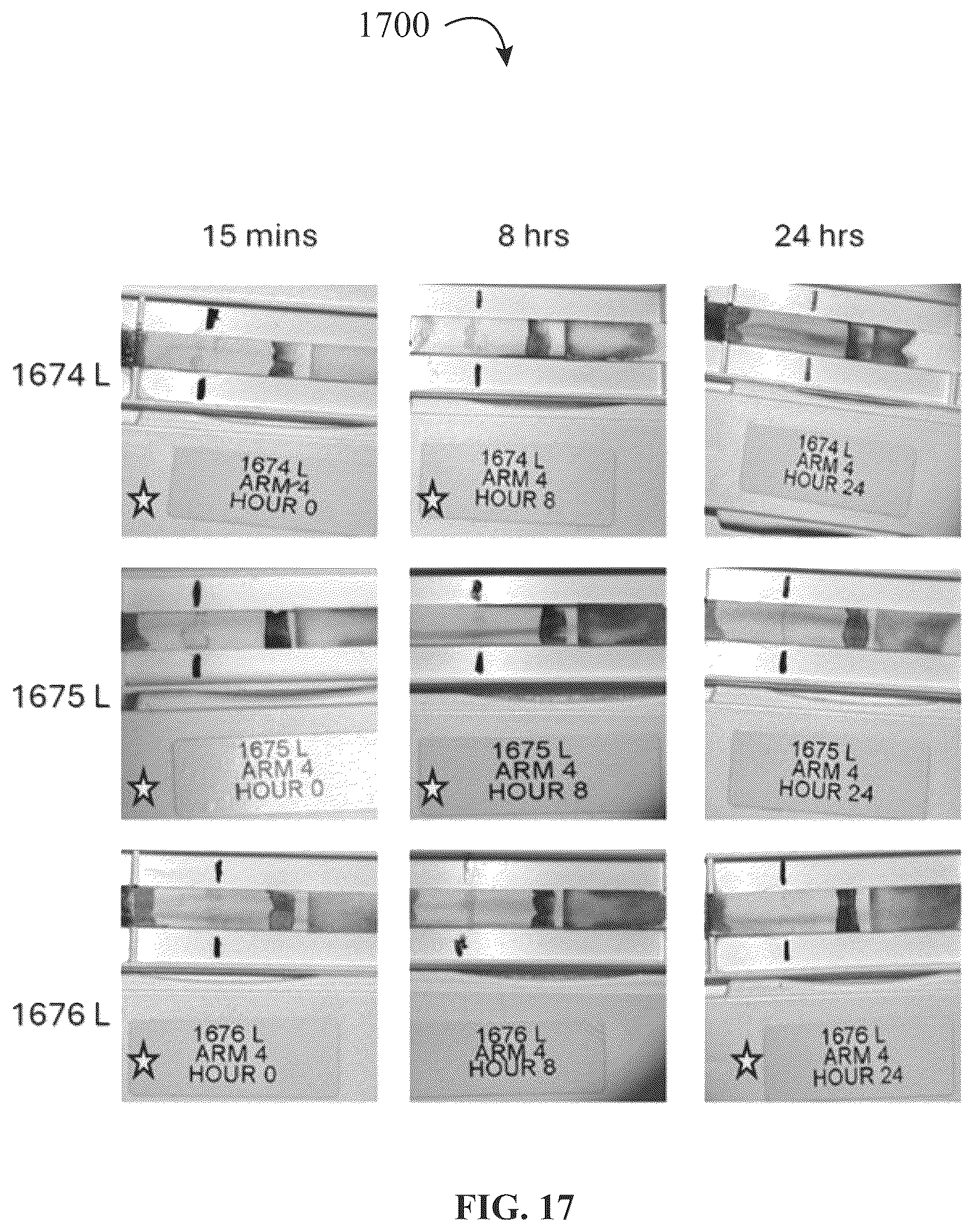 Patent US12320816 Figure 17 – Assay device for diagnosis of open-globe ocular injuries