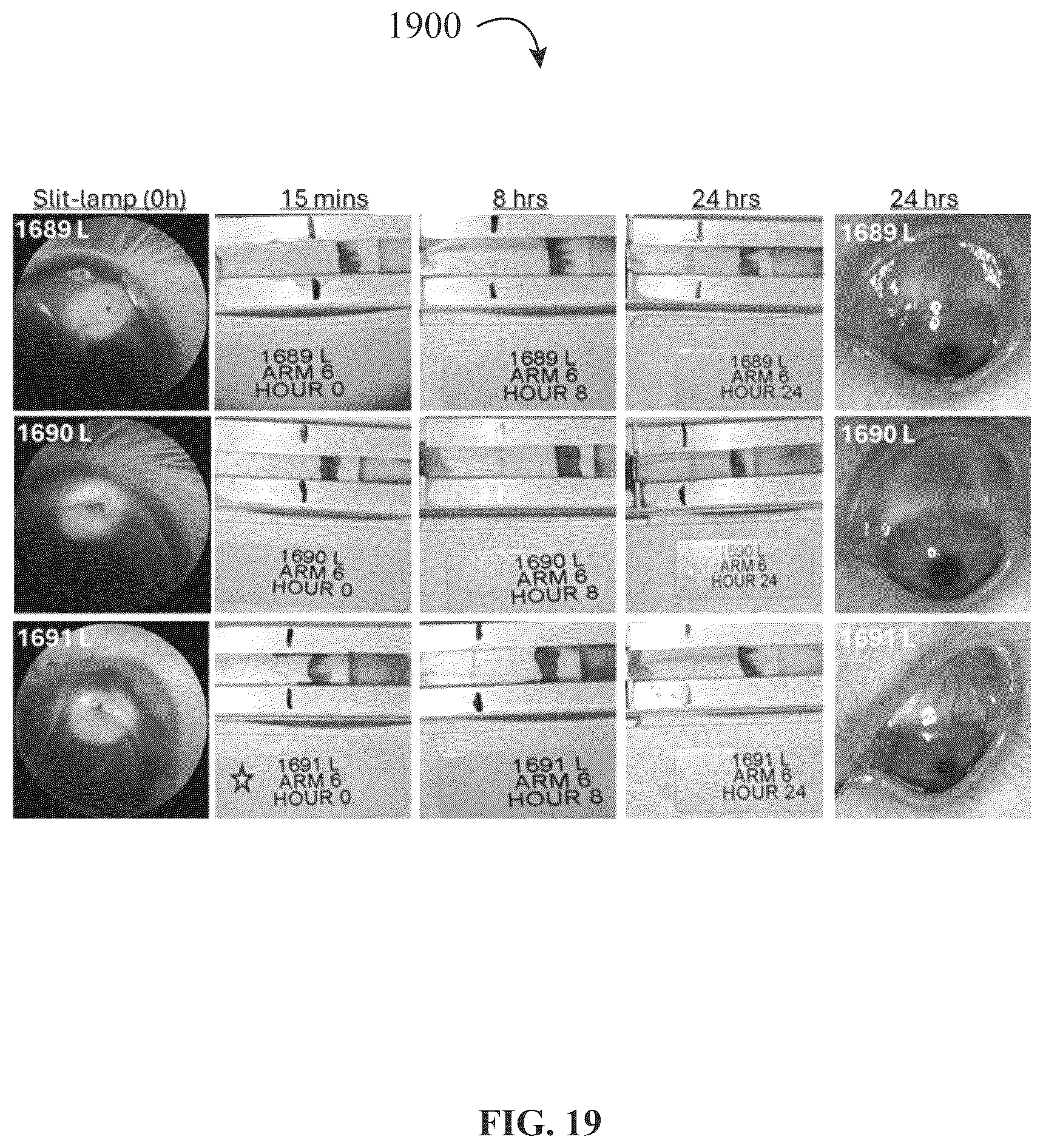 Patent US12320816 Figure 19 – Assay device for diagnosis of open-globe ocular injuries