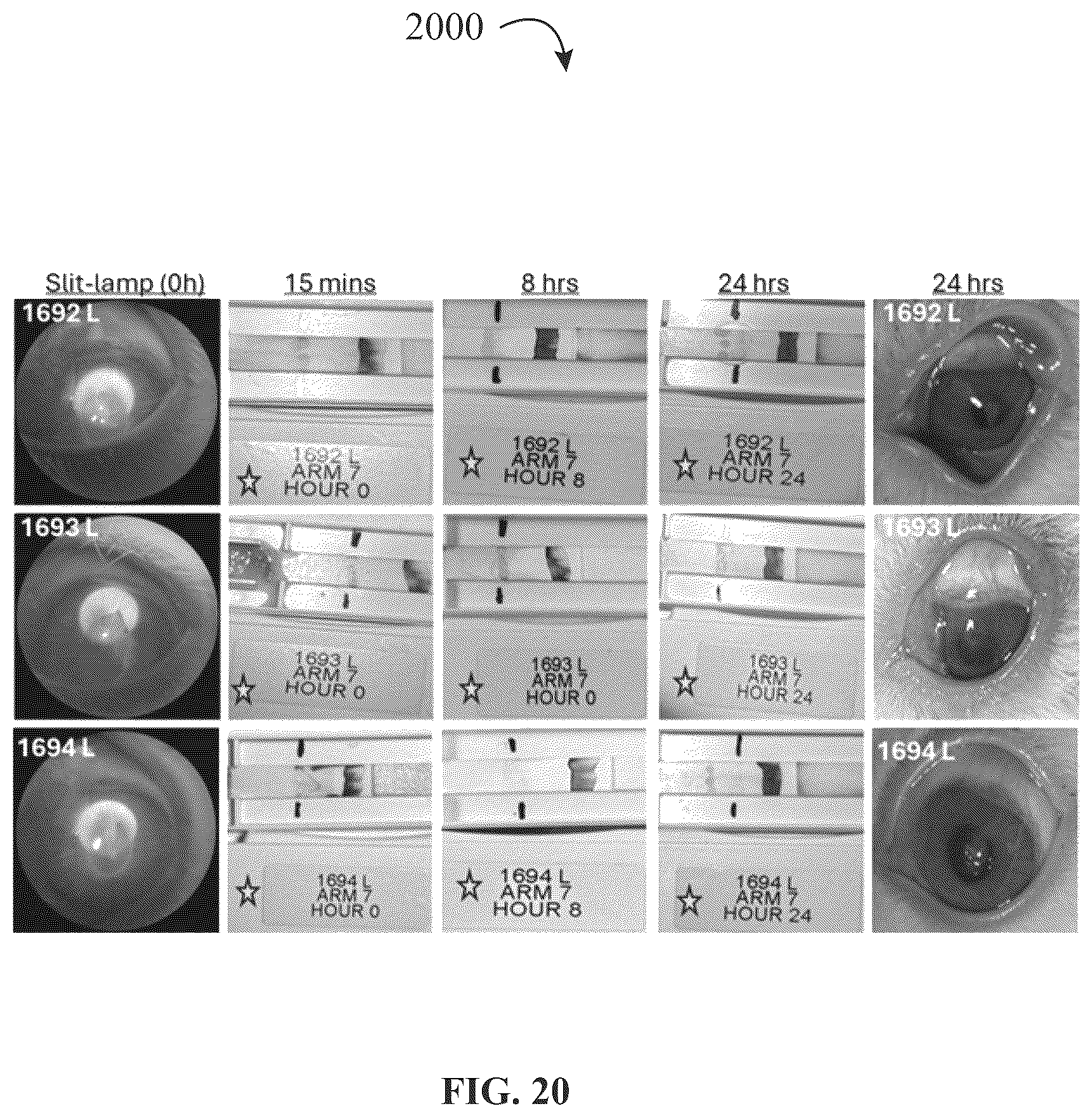 Patent US12320816 Figure 20 – Assay device for diagnosis of open-globe ocular injuries