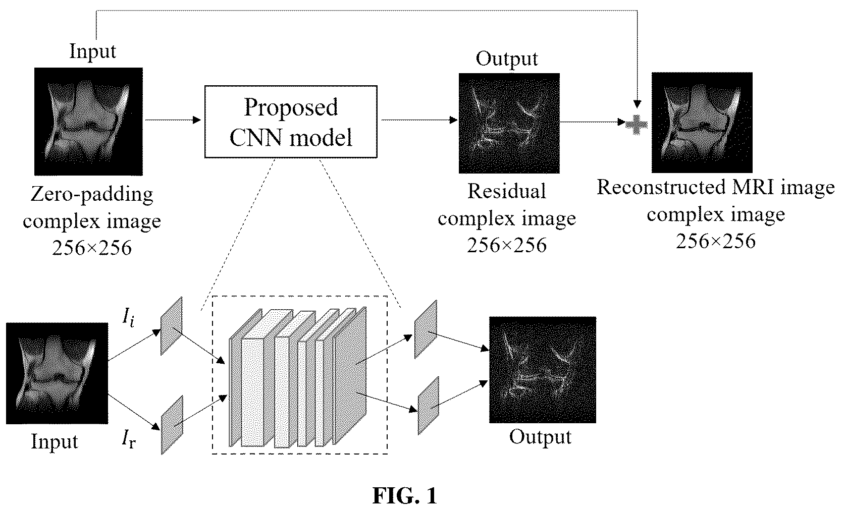 Patent US12320878 Figure 1 – Systems and methods for magnetic resonance image reconstruction from incomplete k-space data