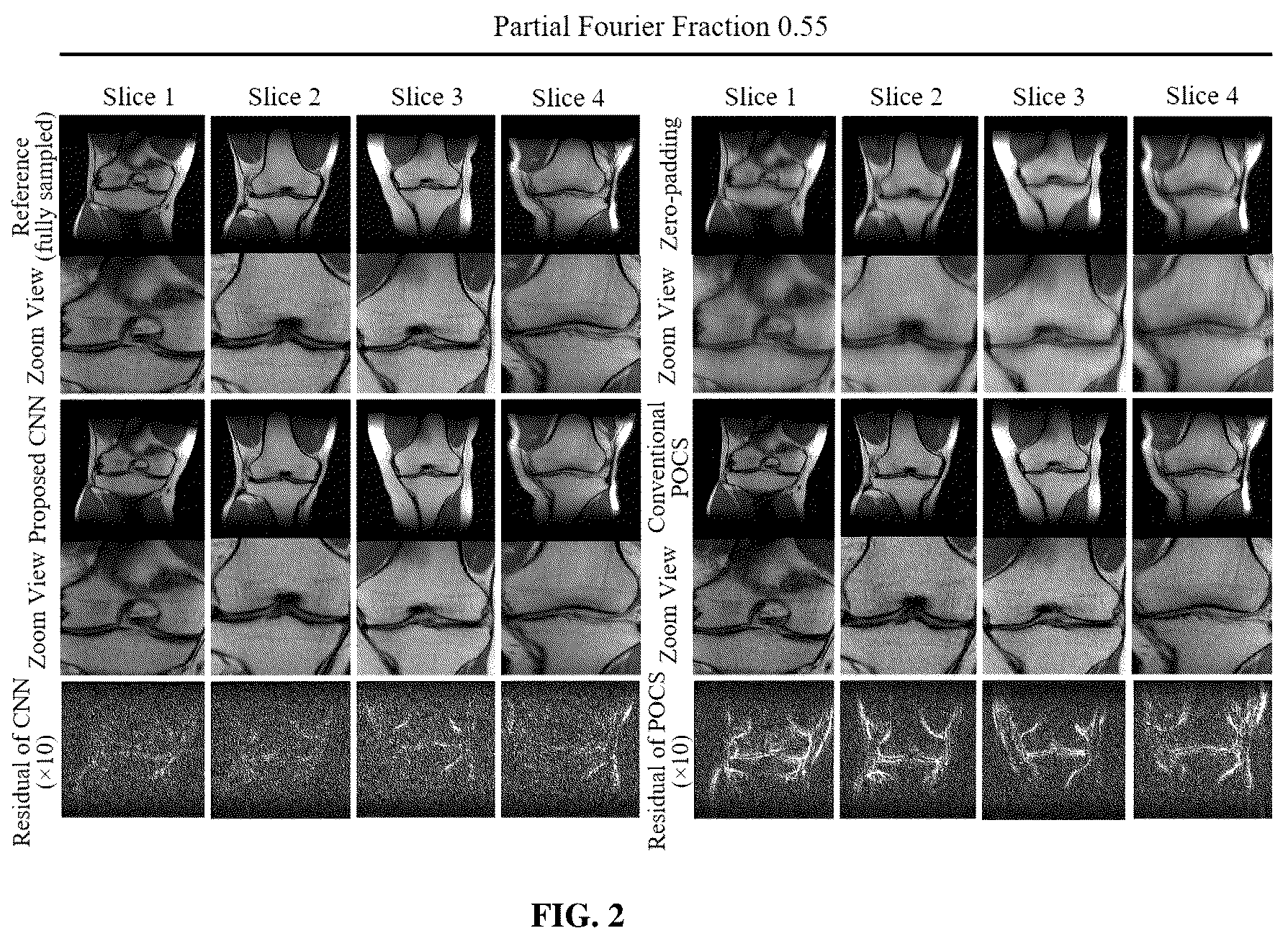 Patent US12320878 Figure 2 – Systems and methods for magnetic resonance image reconstruction from incomplete k-space data
