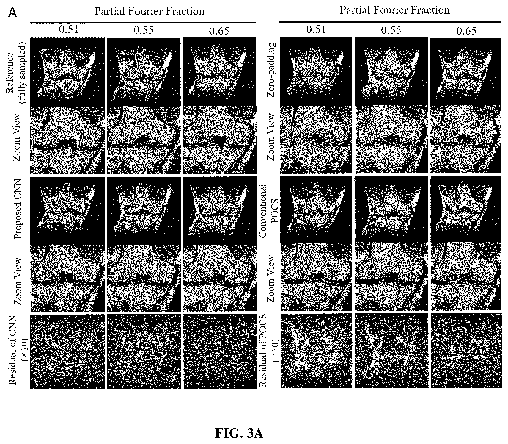 Patent US12320878 Figure 3 – Systems and methods for magnetic resonance image reconstruction from incomplete k-space data