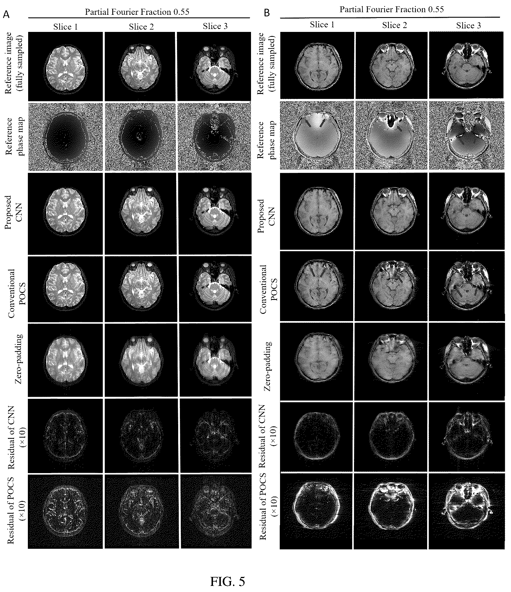 Patent US12320878 Figure 6 – Systems and methods for magnetic resonance image reconstruction from incomplete k-space data