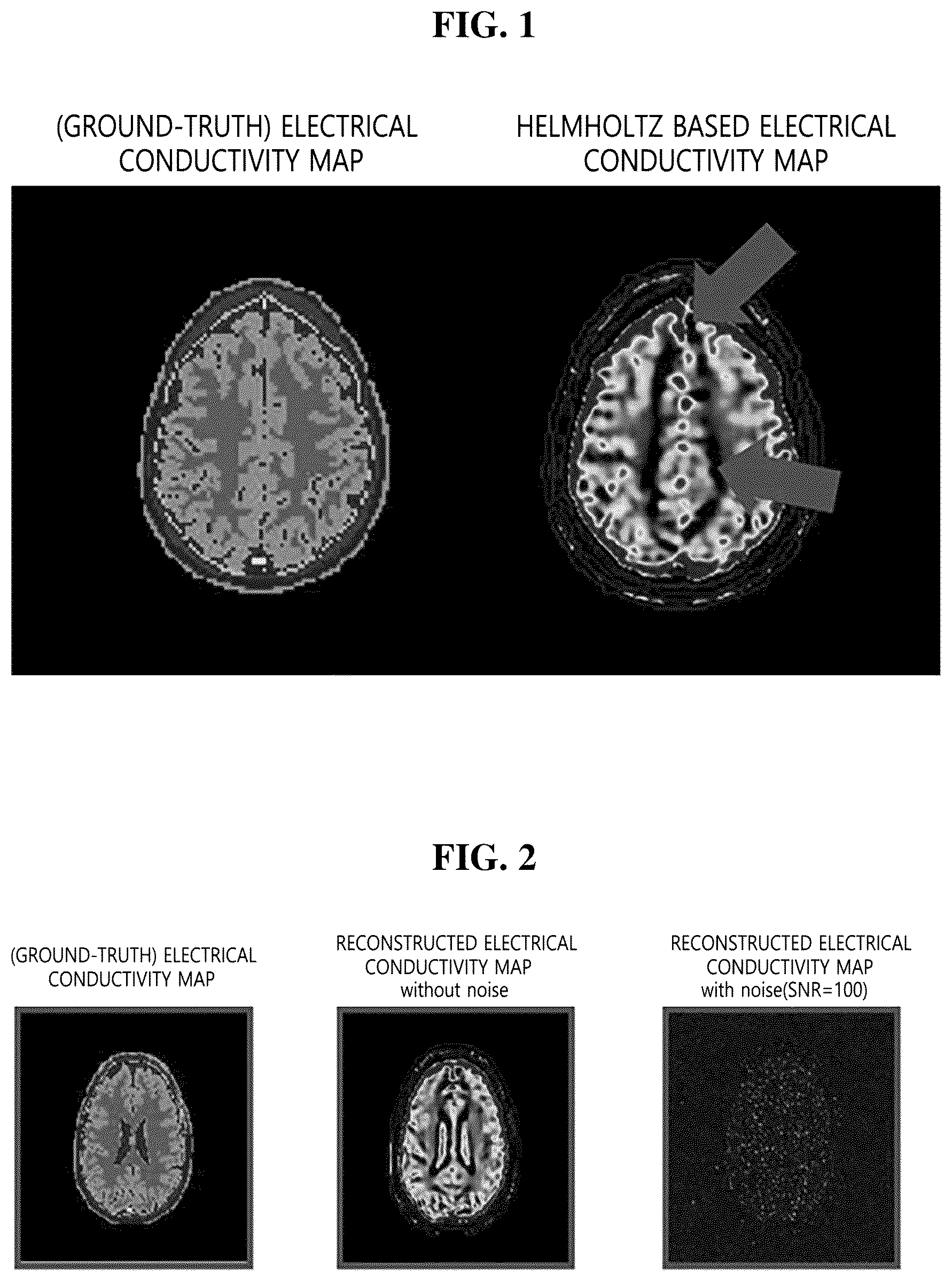 Patent US12320879 Figure 1 – Method and apparatus for reconstructing an electrical conductivity map from magnetic resonance imaging