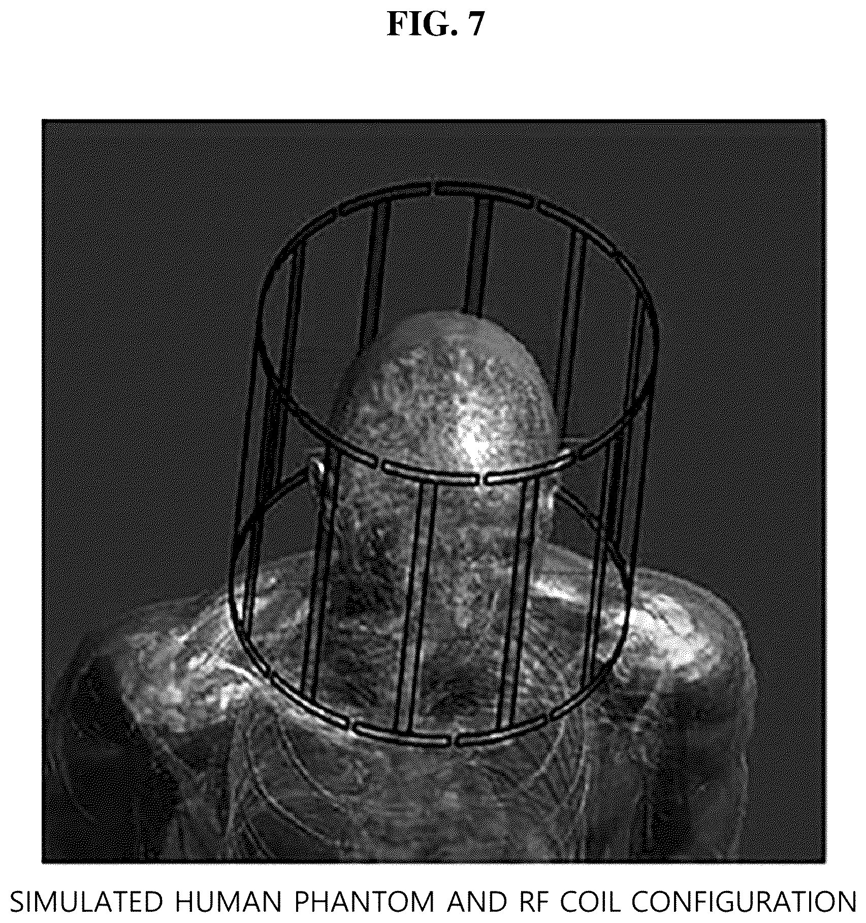 Patent US12320879 Figure 4 – Method and apparatus for reconstructing an electrical conductivity map from magnetic resonance imaging