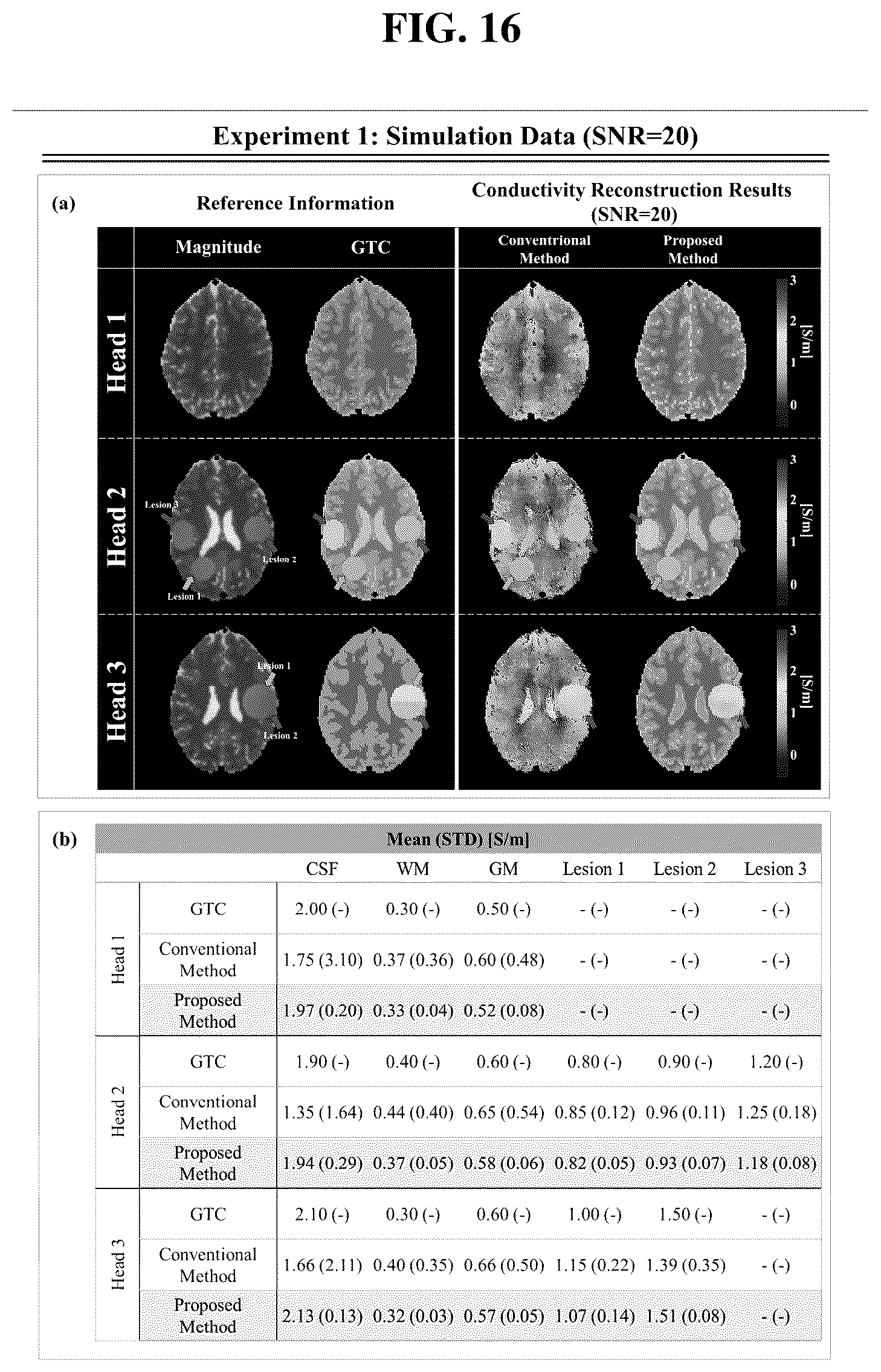 Patent US12320879 Figure 12 – Method and apparatus for reconstructing an electrical conductivity map from magnetic resonance imaging