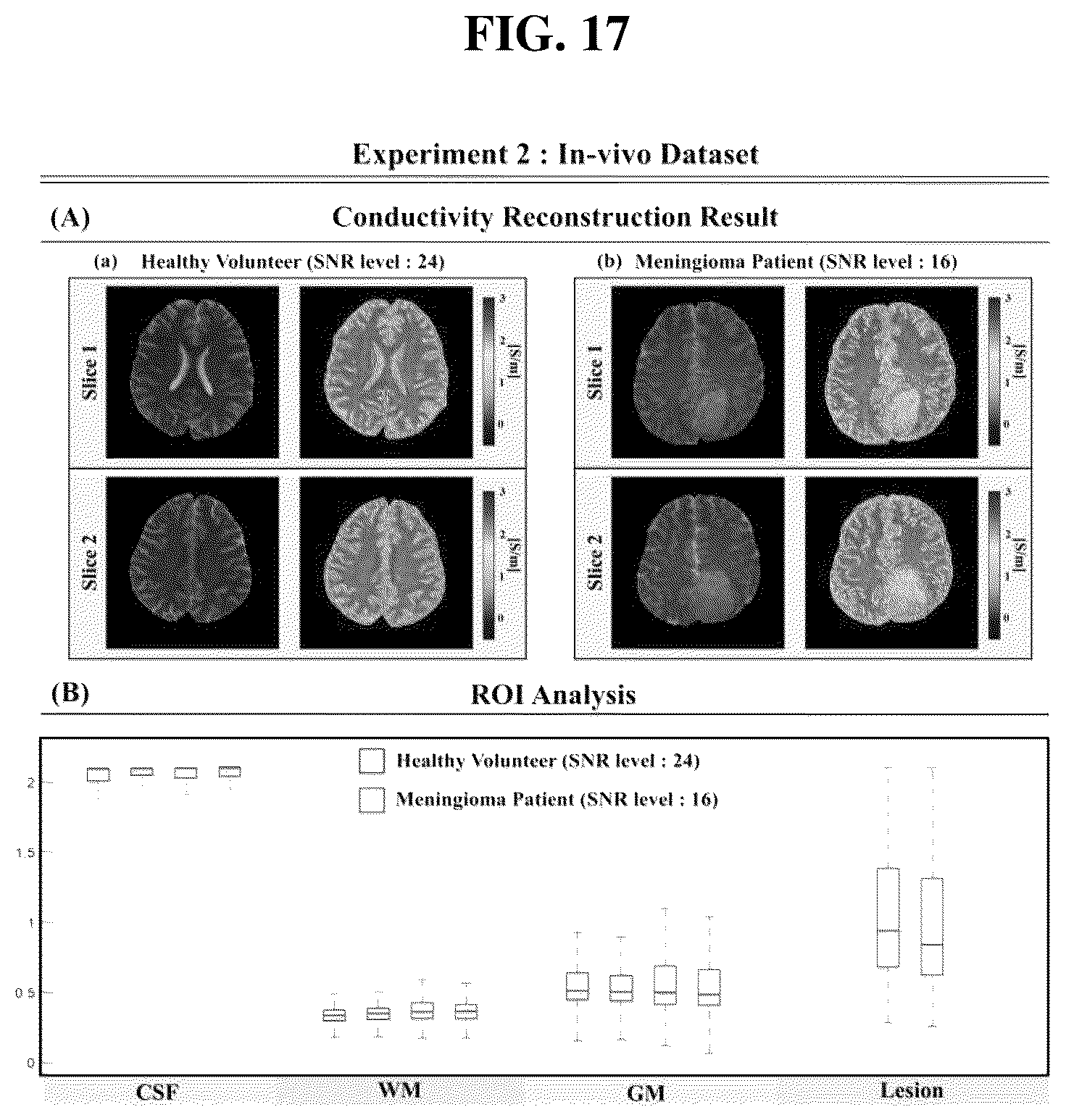 Patent US12320879 Figure 13 – Method and apparatus for reconstructing an electrical conductivity map from magnetic resonance imaging
