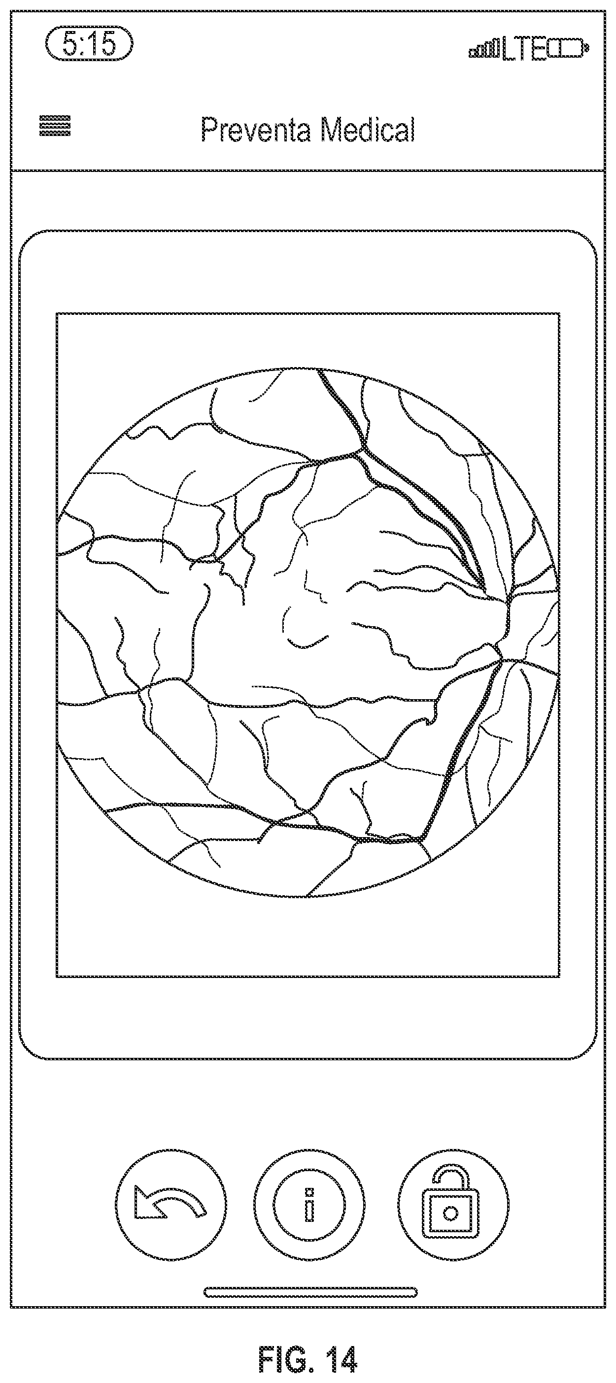 Patent US12320951 Figure 6 – Illuminated contact lens and system