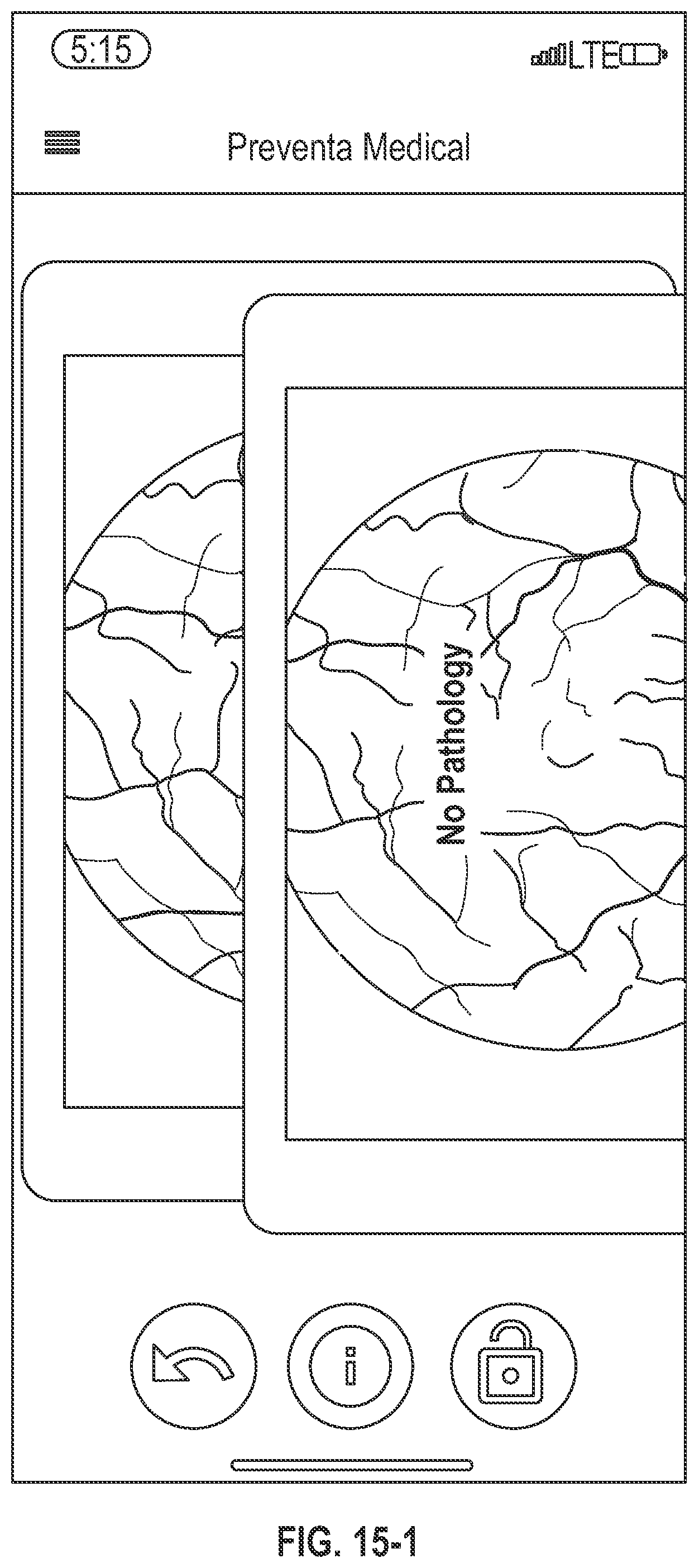 Patent US12320951 Figure 7 – Illuminated contact lens and system
