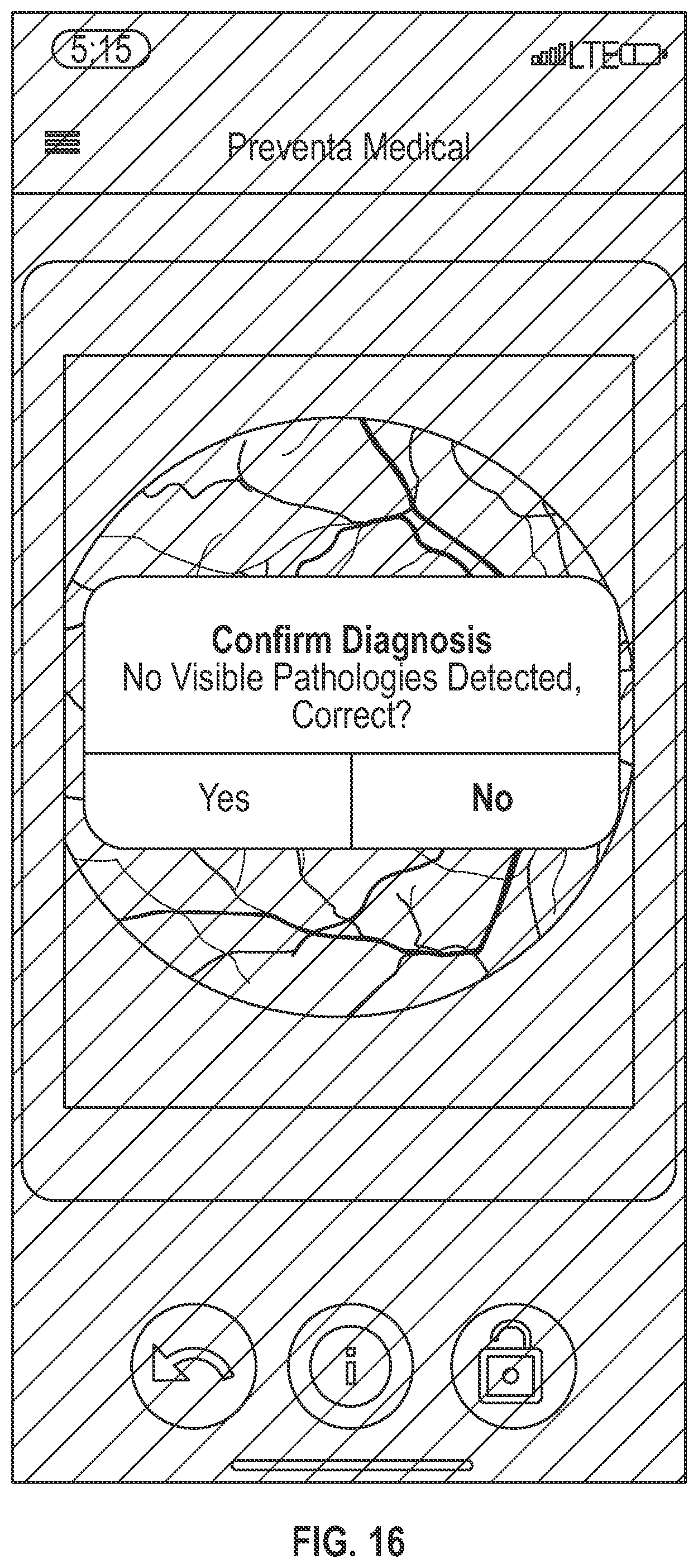 Patent US12320951 Figure 9 – Illuminated contact lens and system