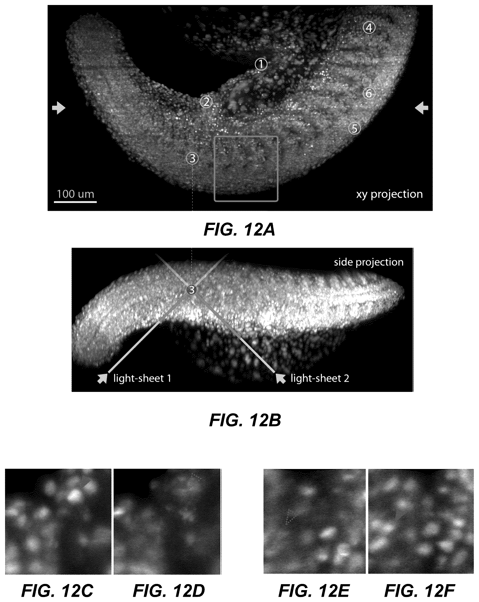 Patent US12320966 Figure 17 – Method and system for multi-view episcopic selective plane illumination microscope