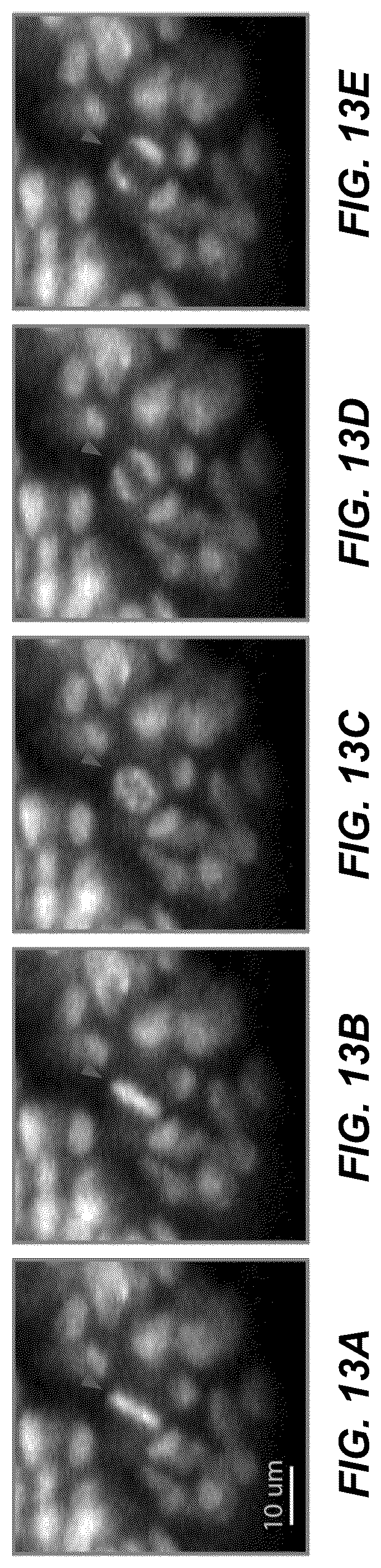 Patent US12320966 Figure 18 – Method and system for multi-view episcopic selective plane illumination microscope