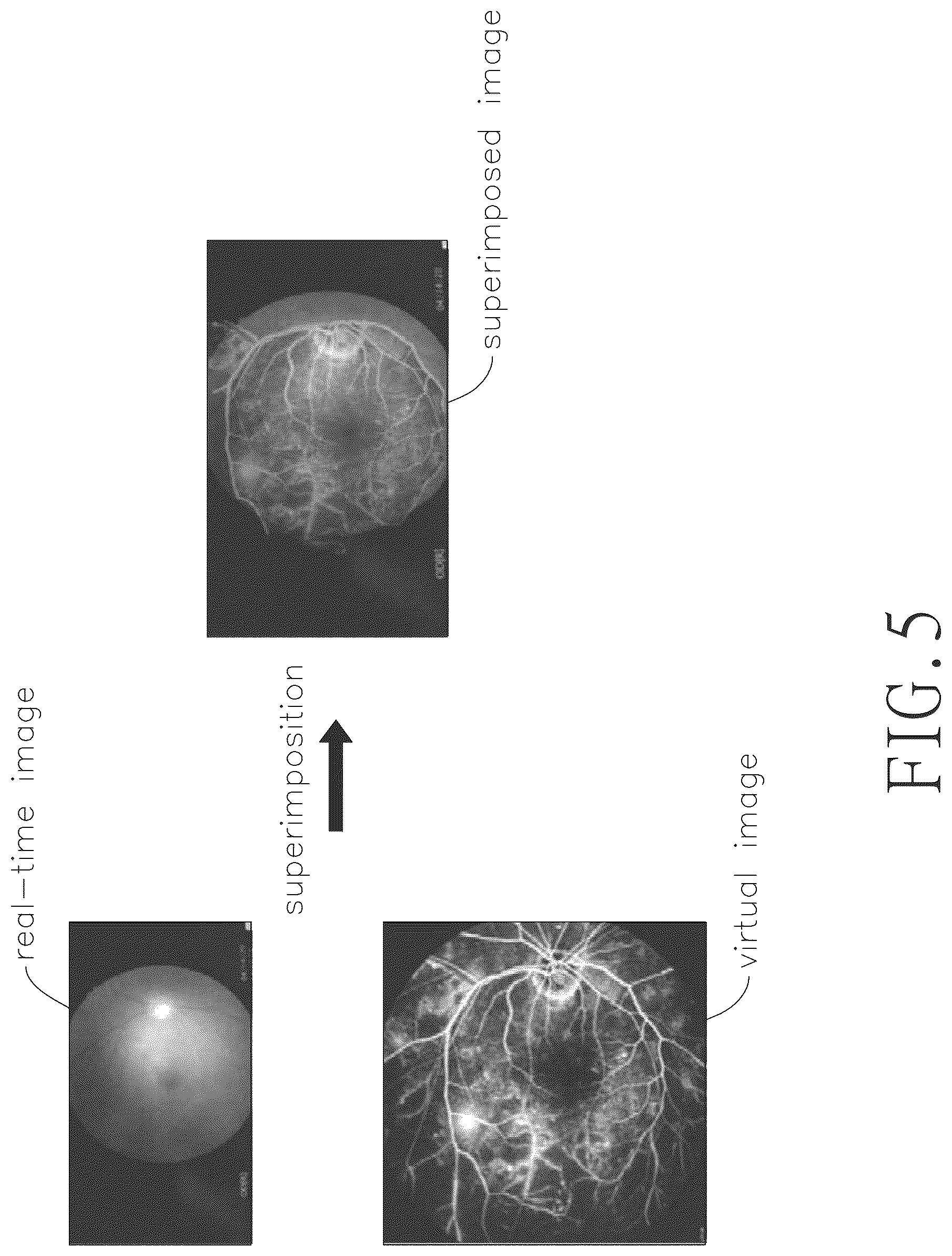Patent US12320984 Figure 10 – Head wearable virtual image module for superimposing virtual image on real-time image