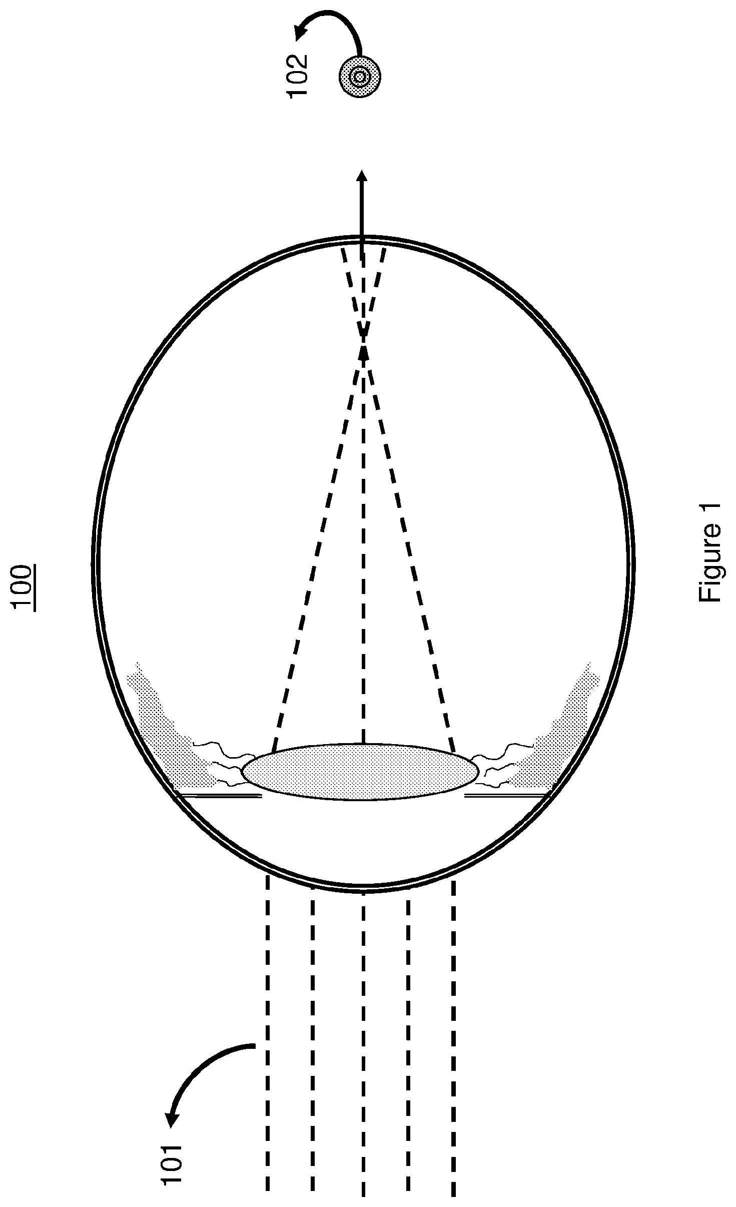 Patent US12321046 Figure 1 – Spectacle lenses with auxiliary optical elements