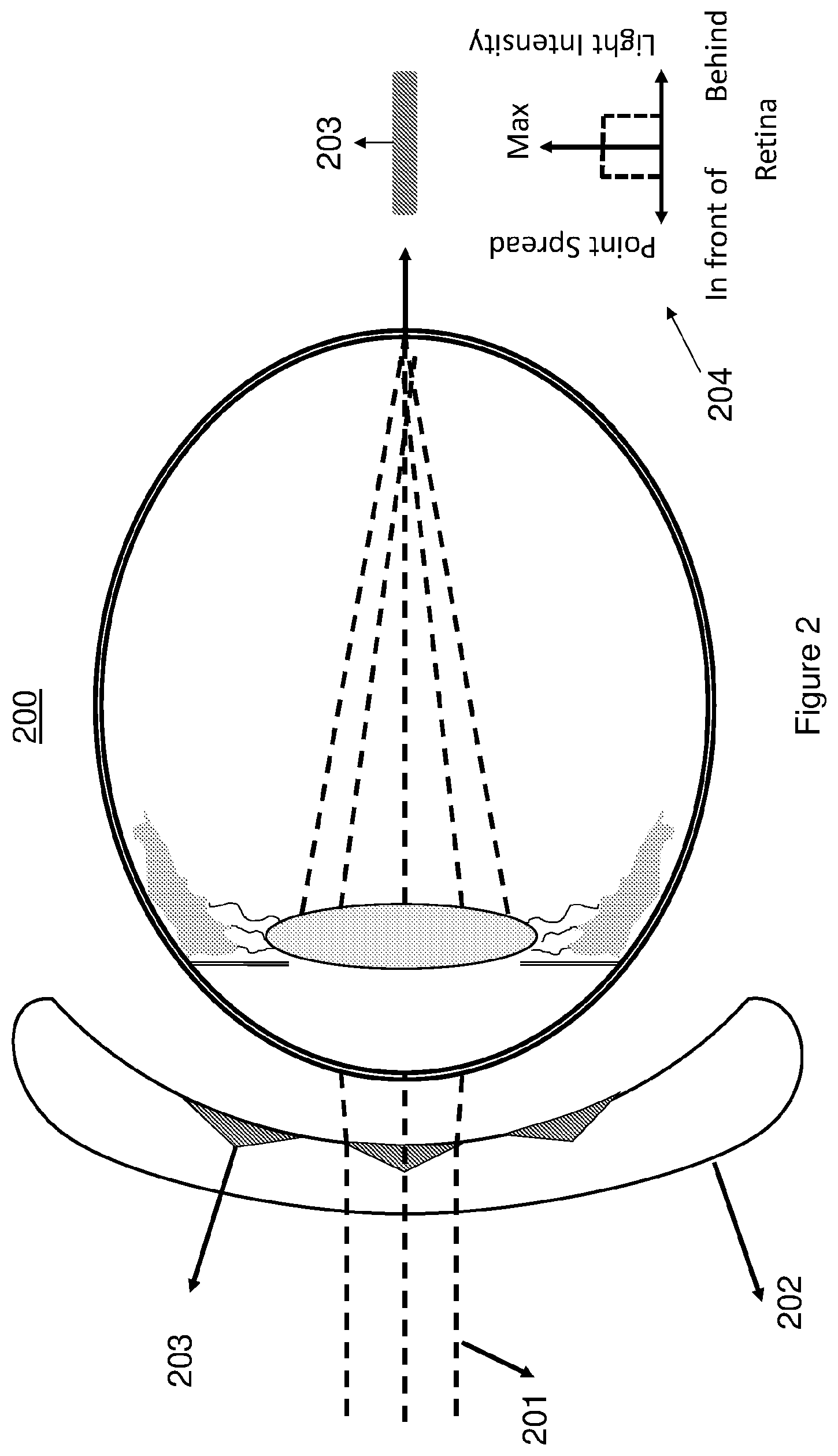 Patent US12321046 Figure 2 – Spectacle lenses with auxiliary optical elements
