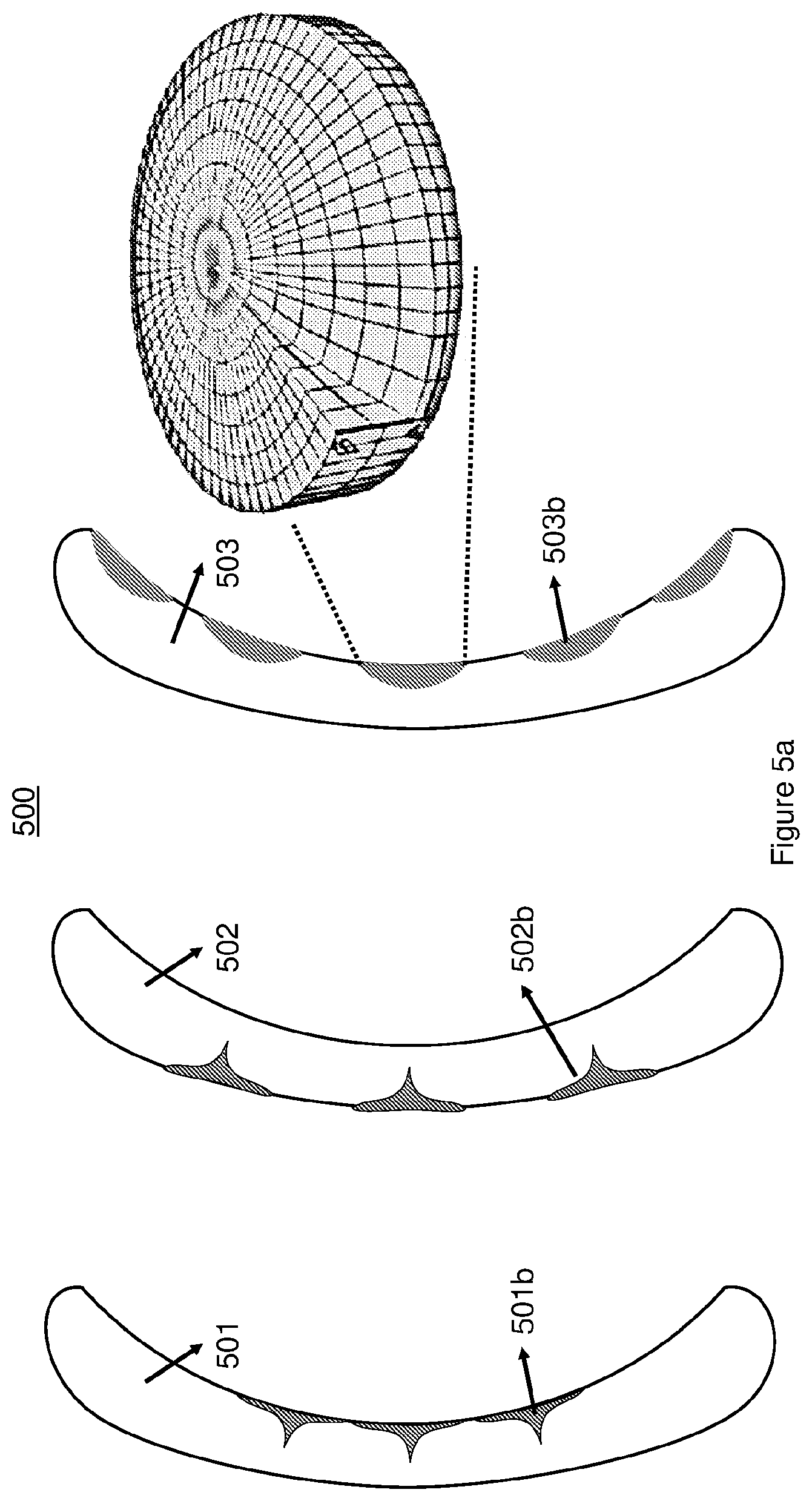 Patent US12321046 Figure 5 – Spectacle lenses with auxiliary optical elements