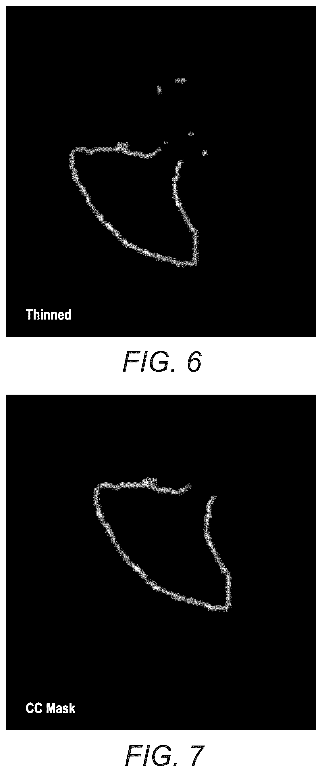 Patent US12321380 Figure 4 – Automatic extraction of regions of interest from annotated images with occluding labels