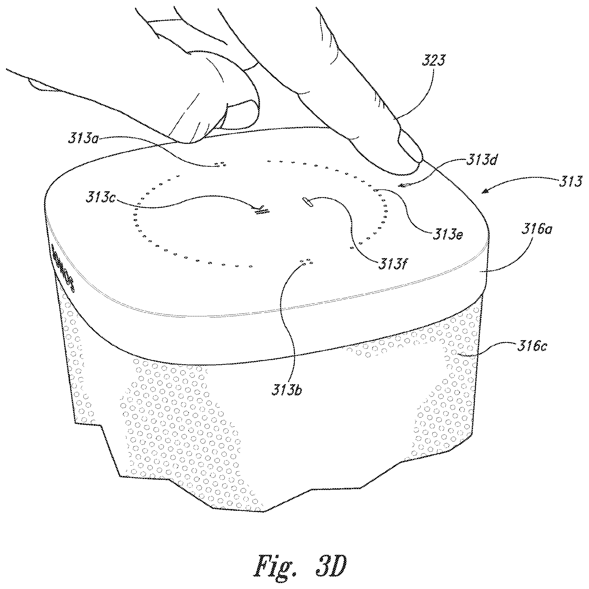 Patent US12321662 Figure 11 – Synchronizing playback of audio information received from other networks
