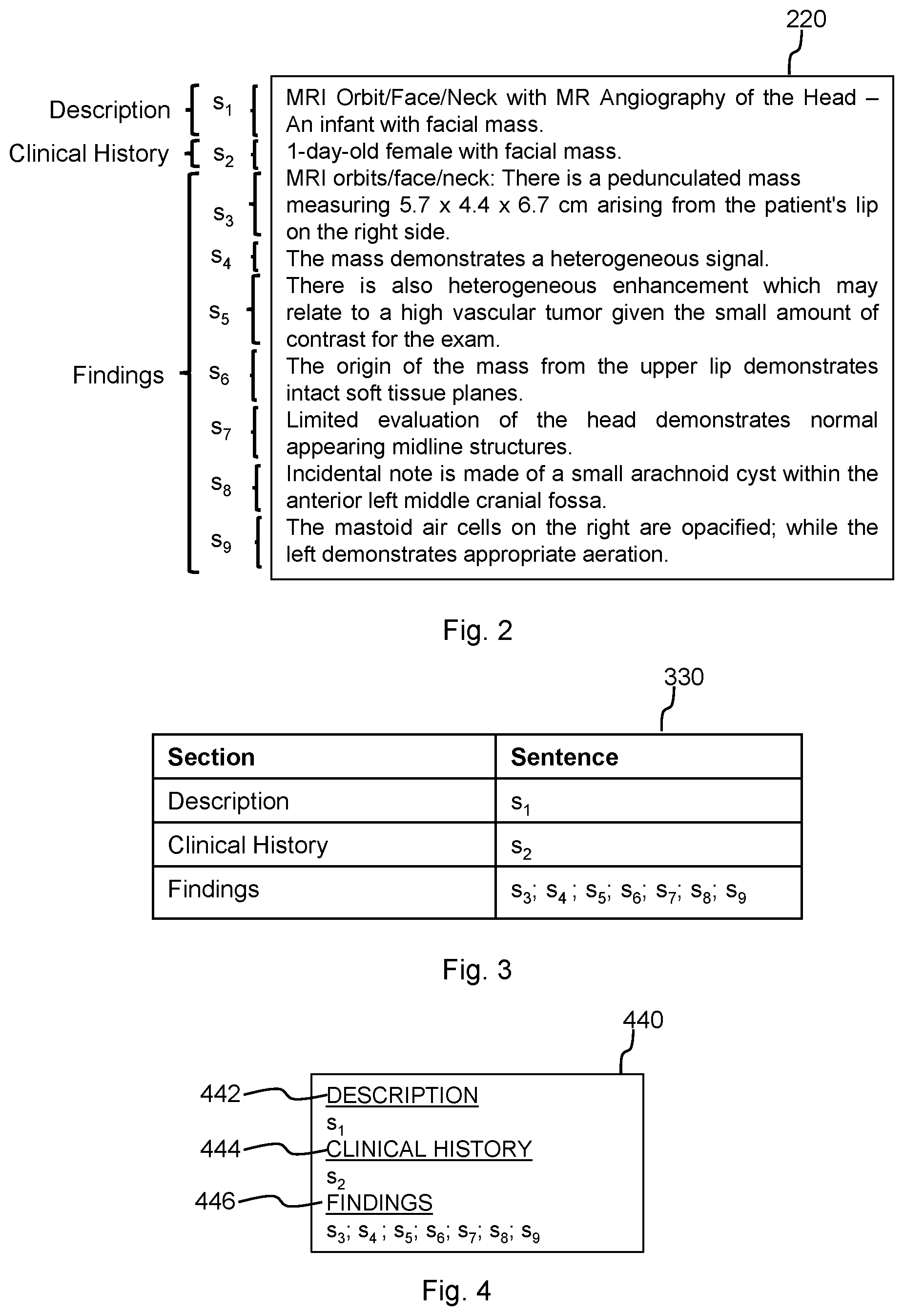 Patent US12321687 Figure 2 – Method and apparatus for segmenting a medical text report into sections