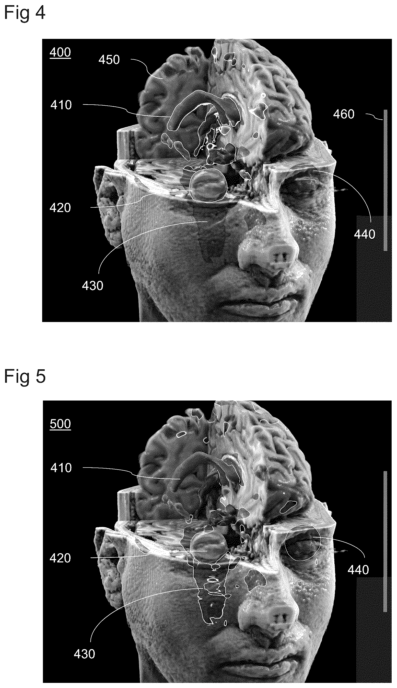 Patent US12322033 Figure 4 – Computer-implemented method for rendering medical volume data