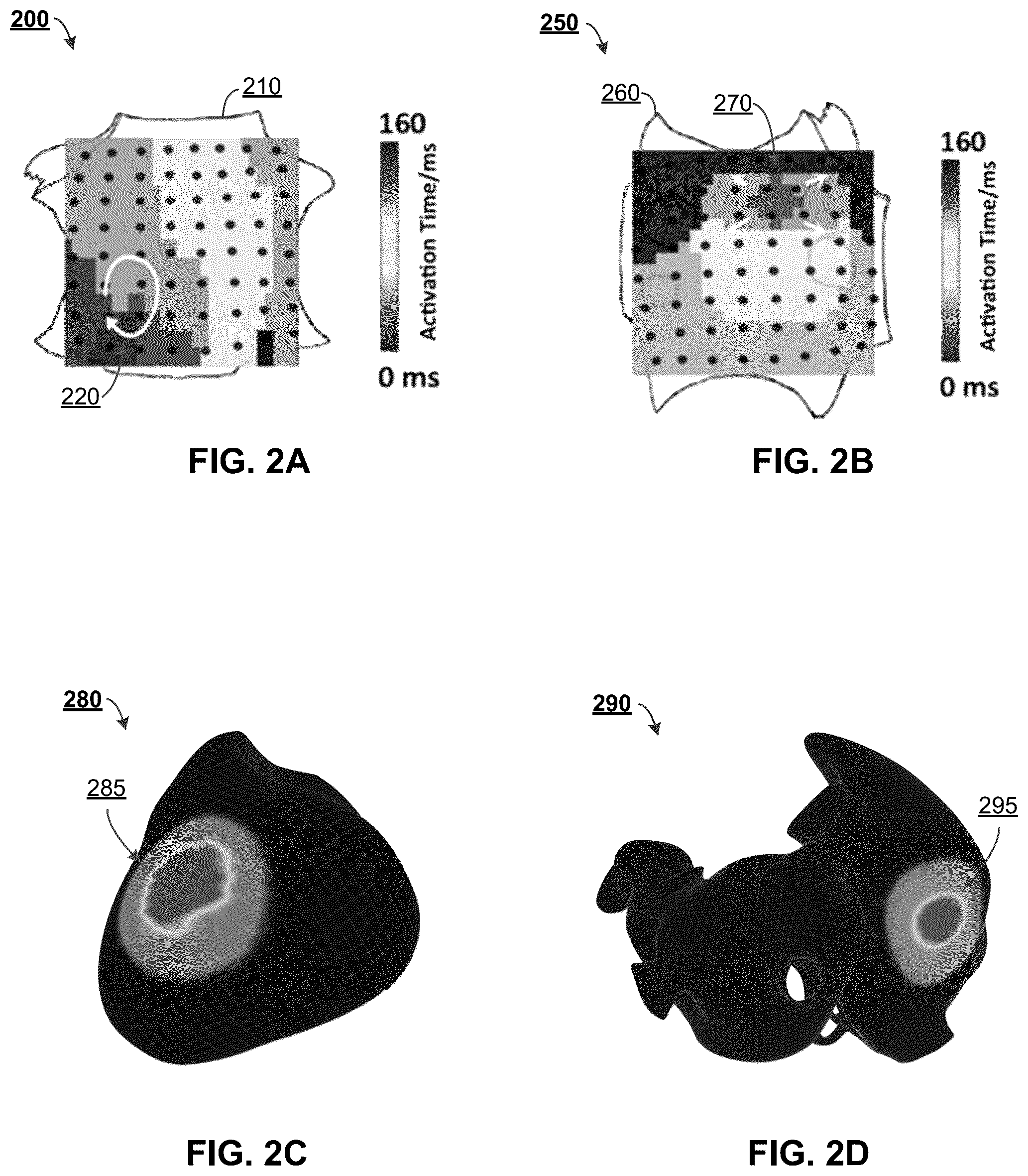 Patent US12322044 Figure 2 – Computational localization of fibrillation sources