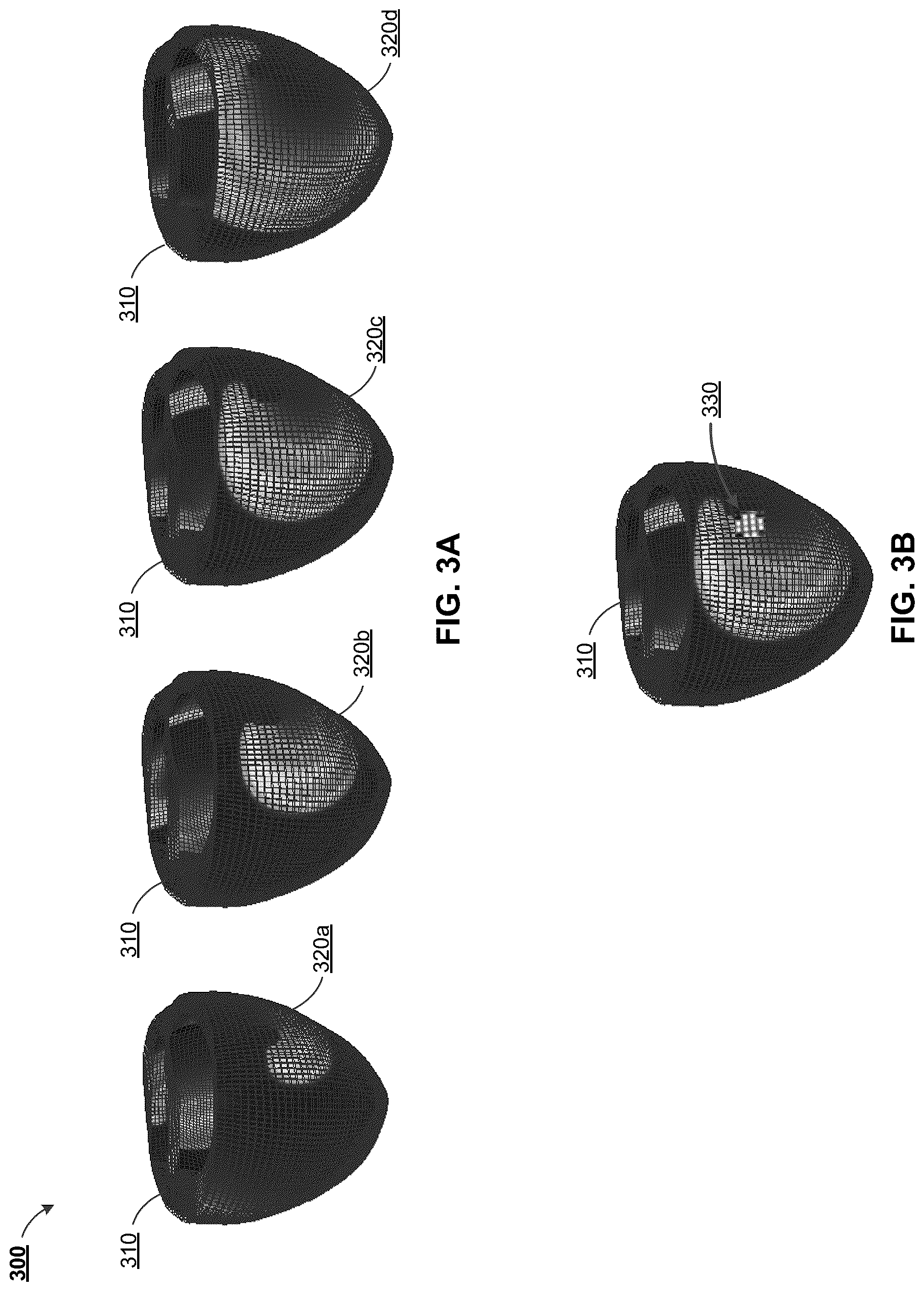 Patent US12322044 Figure 3 – Computational localization of fibrillation sources