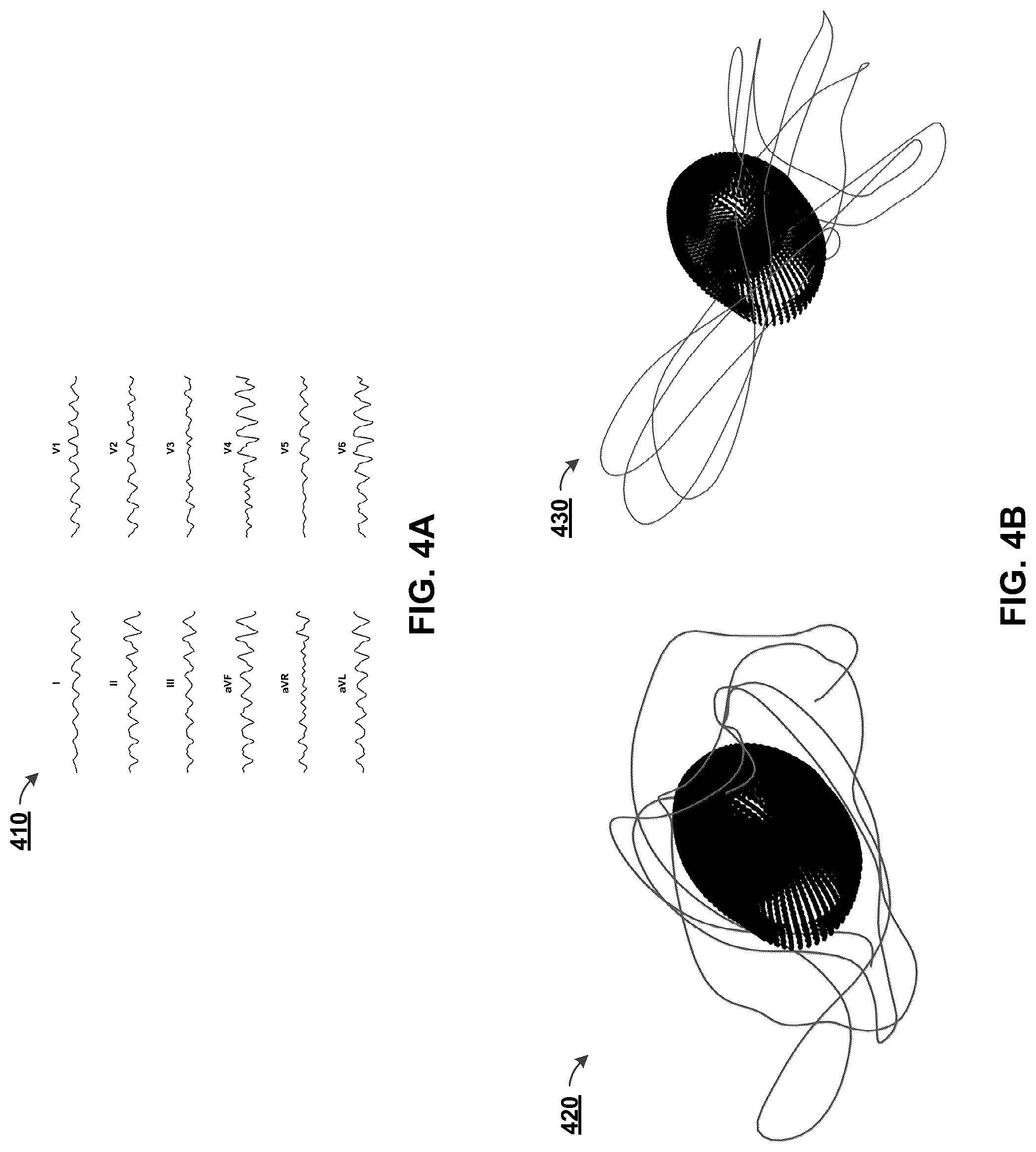 Patent US12322044 Figure 4 – Computational localization of fibrillation sources