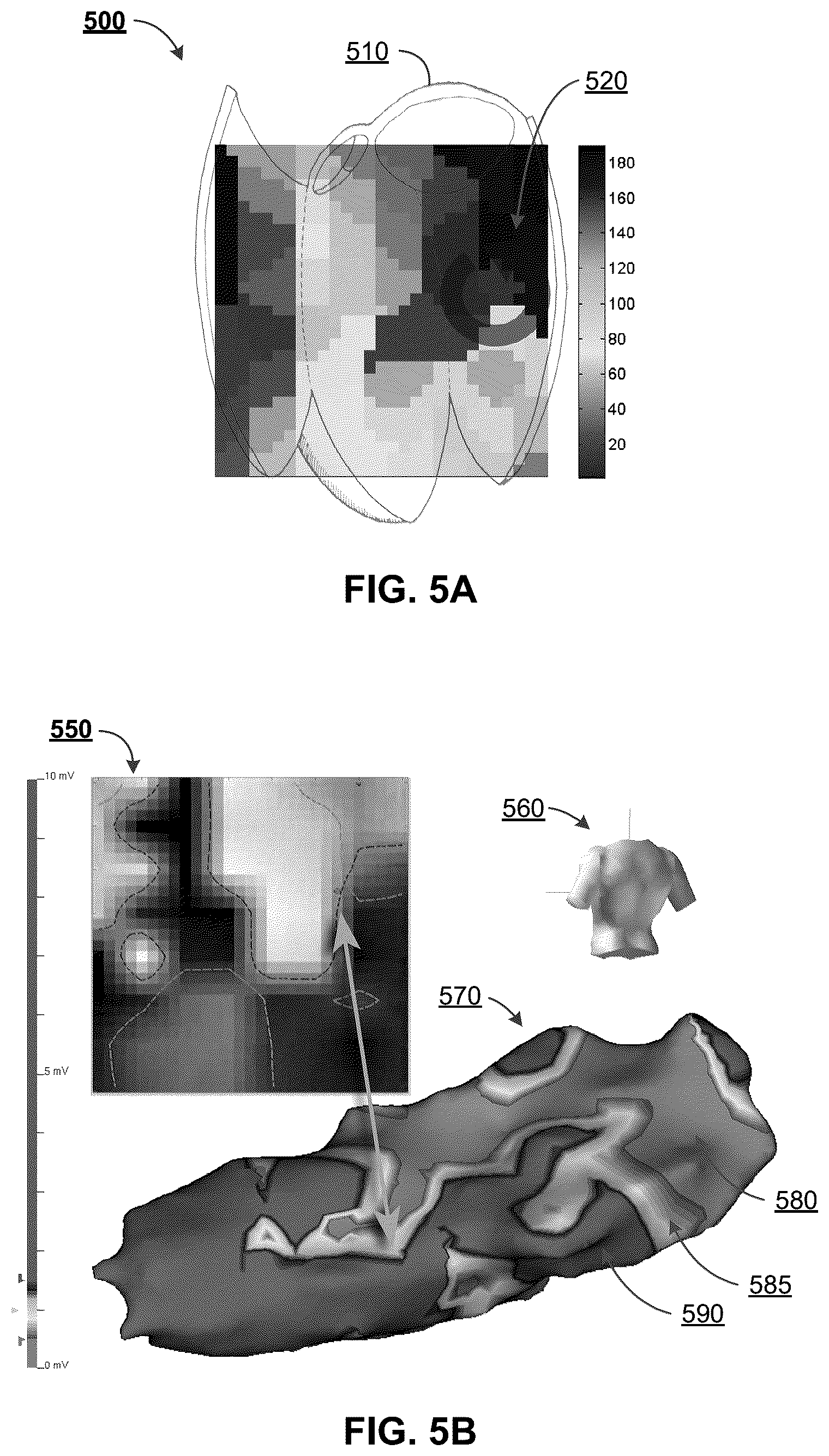 Patent US12322044 Figure 5 – Computational localization of fibrillation sources