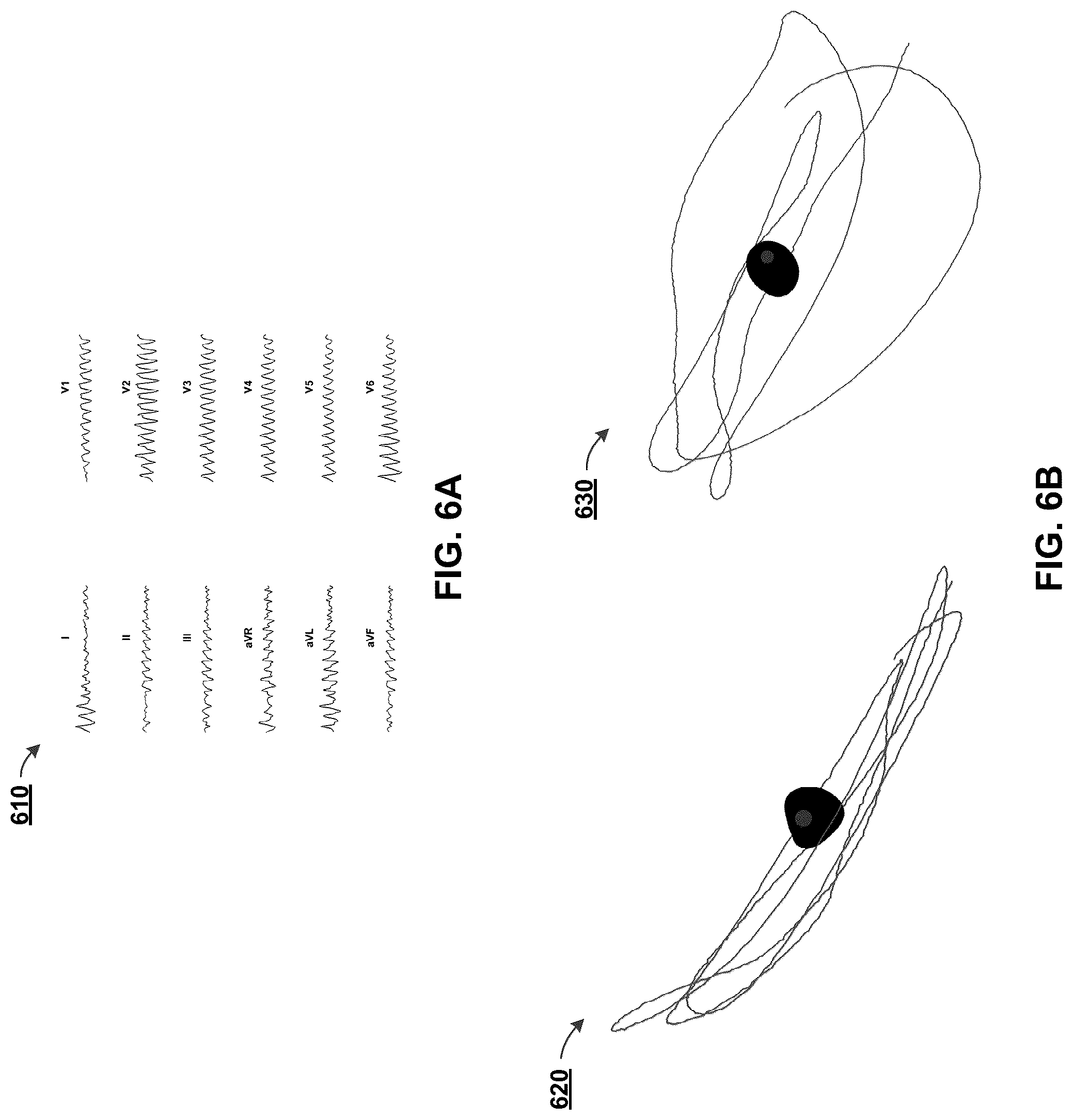 Patent US12322044 Figure 6 – Computational localization of fibrillation sources