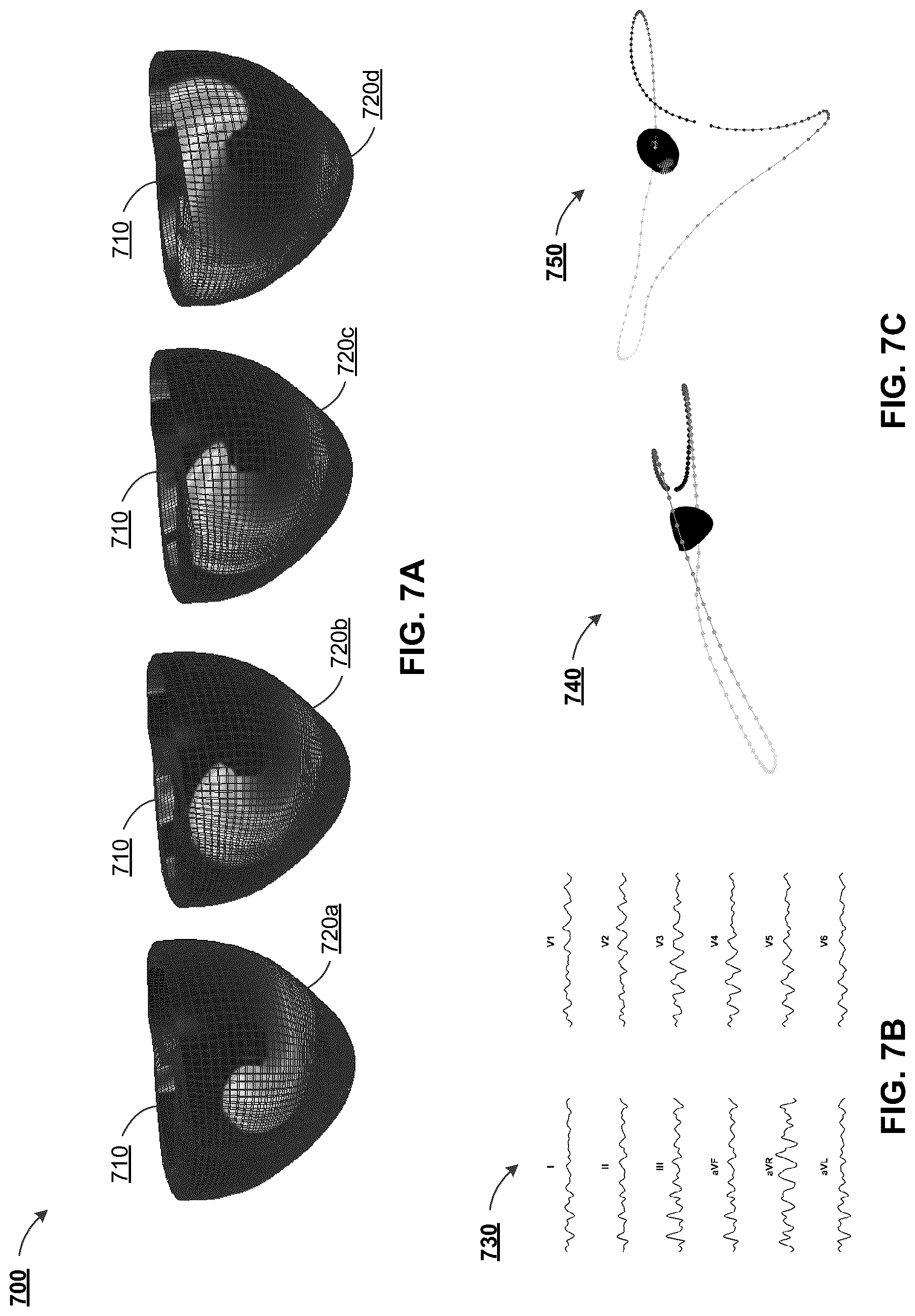 Patent US12322044 Figure 7 – Computational localization of fibrillation sources
