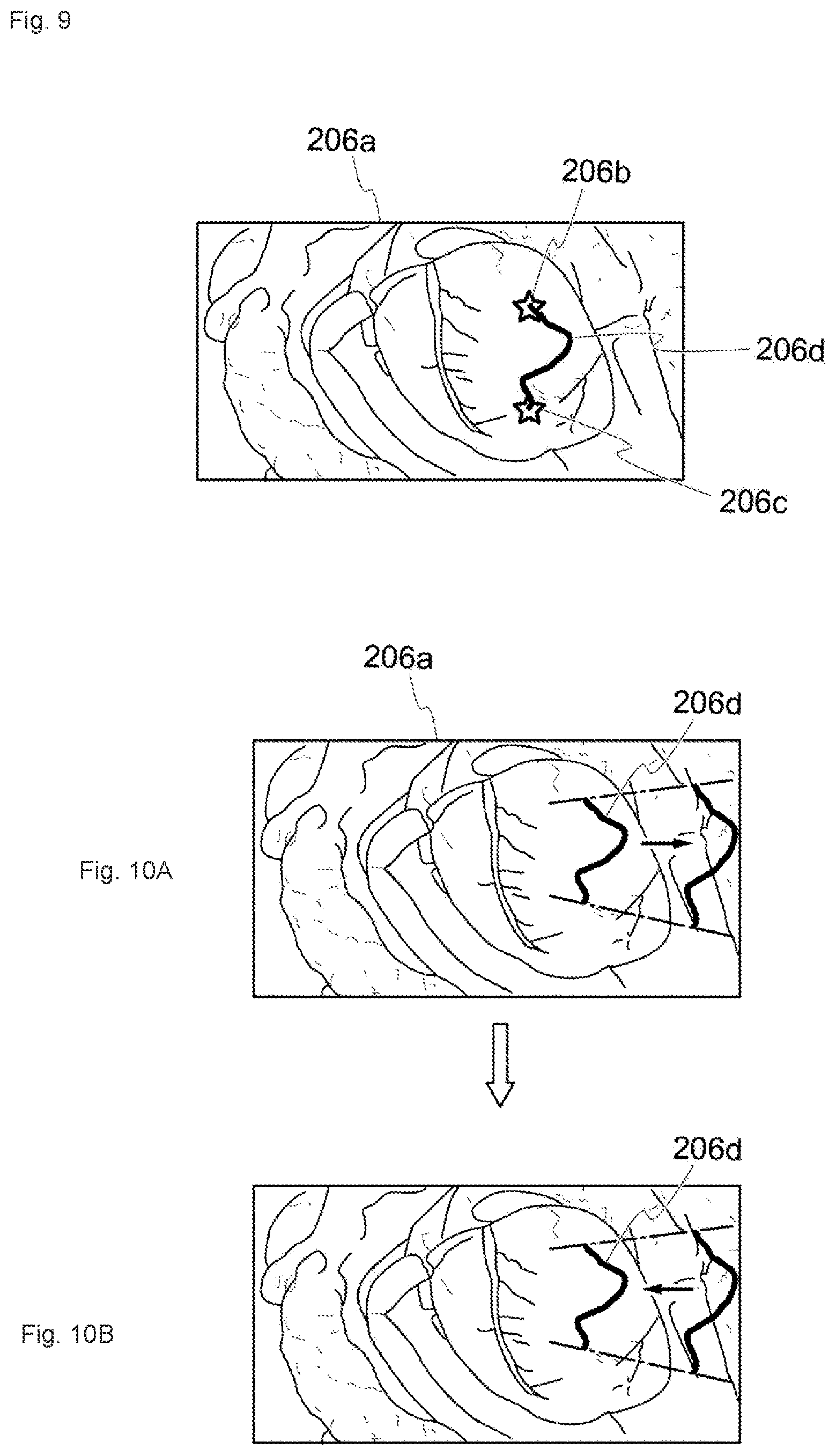 Patent US12322049 Figure 8 – Medical image processing system, surgical image control device, and surgical image control method