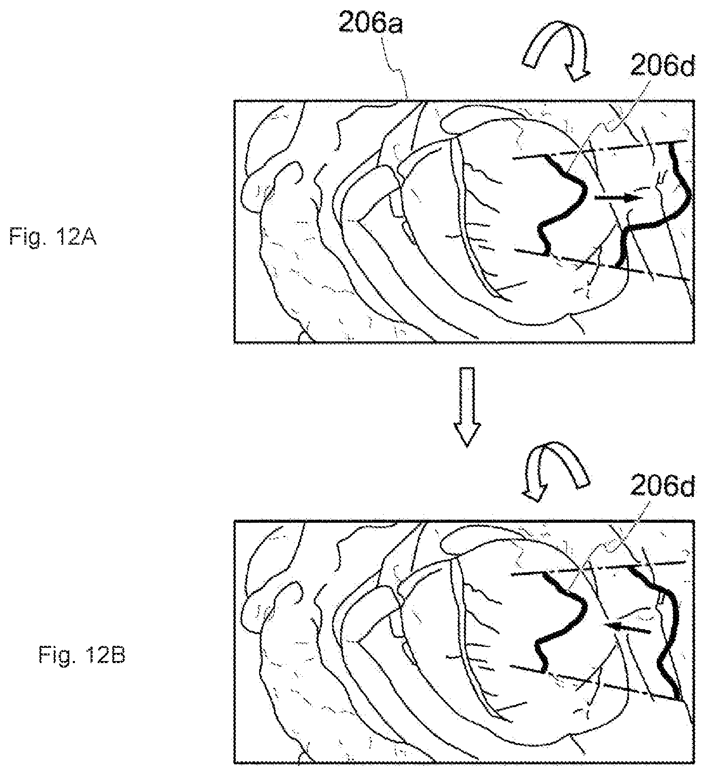 Patent US12322049 Figure 10 – Medical image processing system, surgical image control device, and surgical image control method