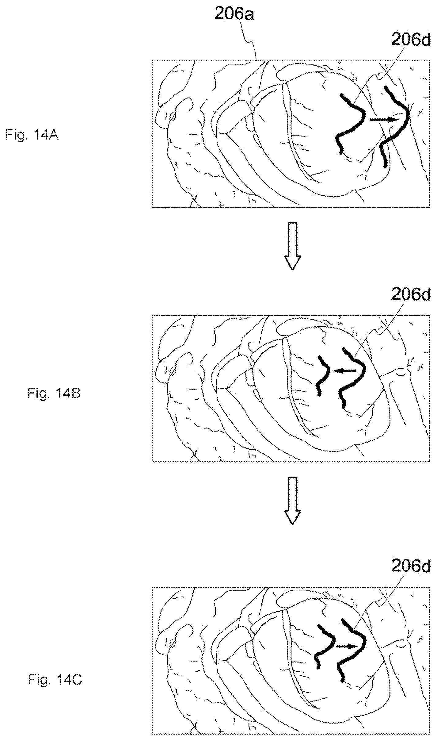 Patent US12322049 Figure 12 – Medical image processing system, surgical image control device, and surgical image control method