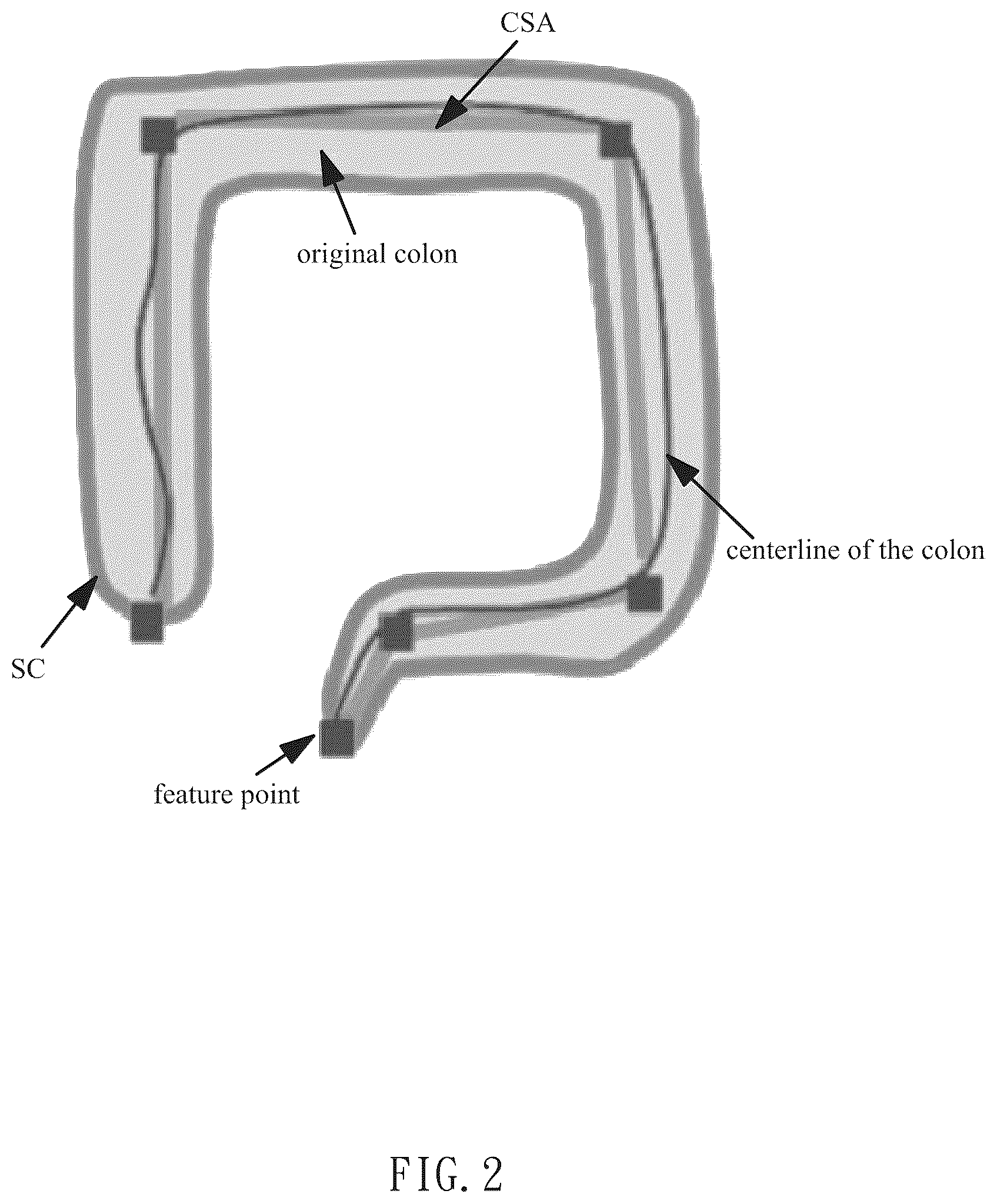 Patent US12322057 Figure 2 – Method for direct manipulation and visualization of the 3D internal structures of a tubular object as they are in reality without any noticeable distortion