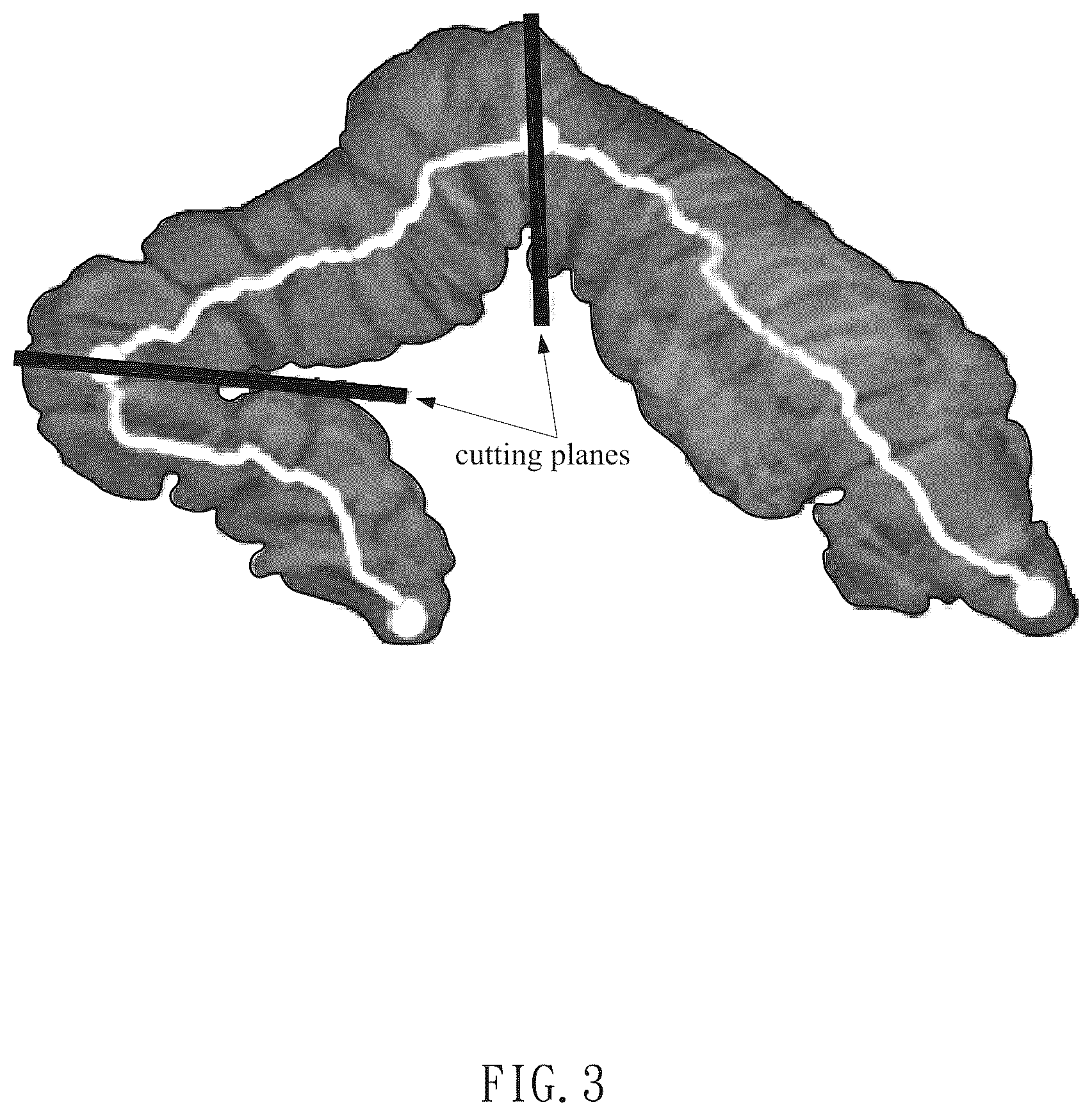 Patent US12322057 Figure 3 – Method for direct manipulation and visualization of the 3D internal structures of a tubular object as they are in reality without any noticeable distortion