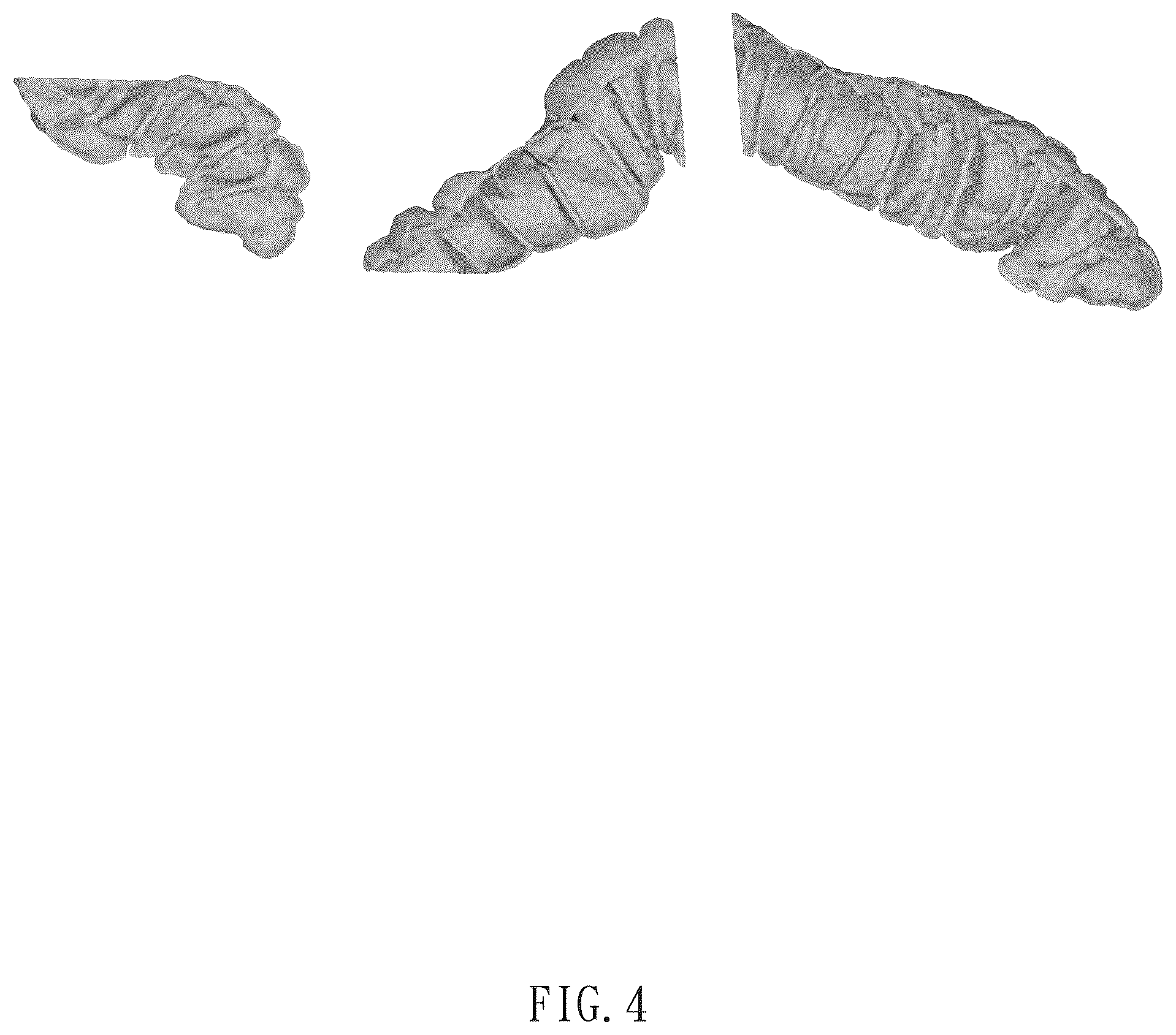 Patent US12322057 Figure 4 – Method for direct manipulation and visualization of the 3D internal structures of a tubular object as they are in reality without any noticeable distortion